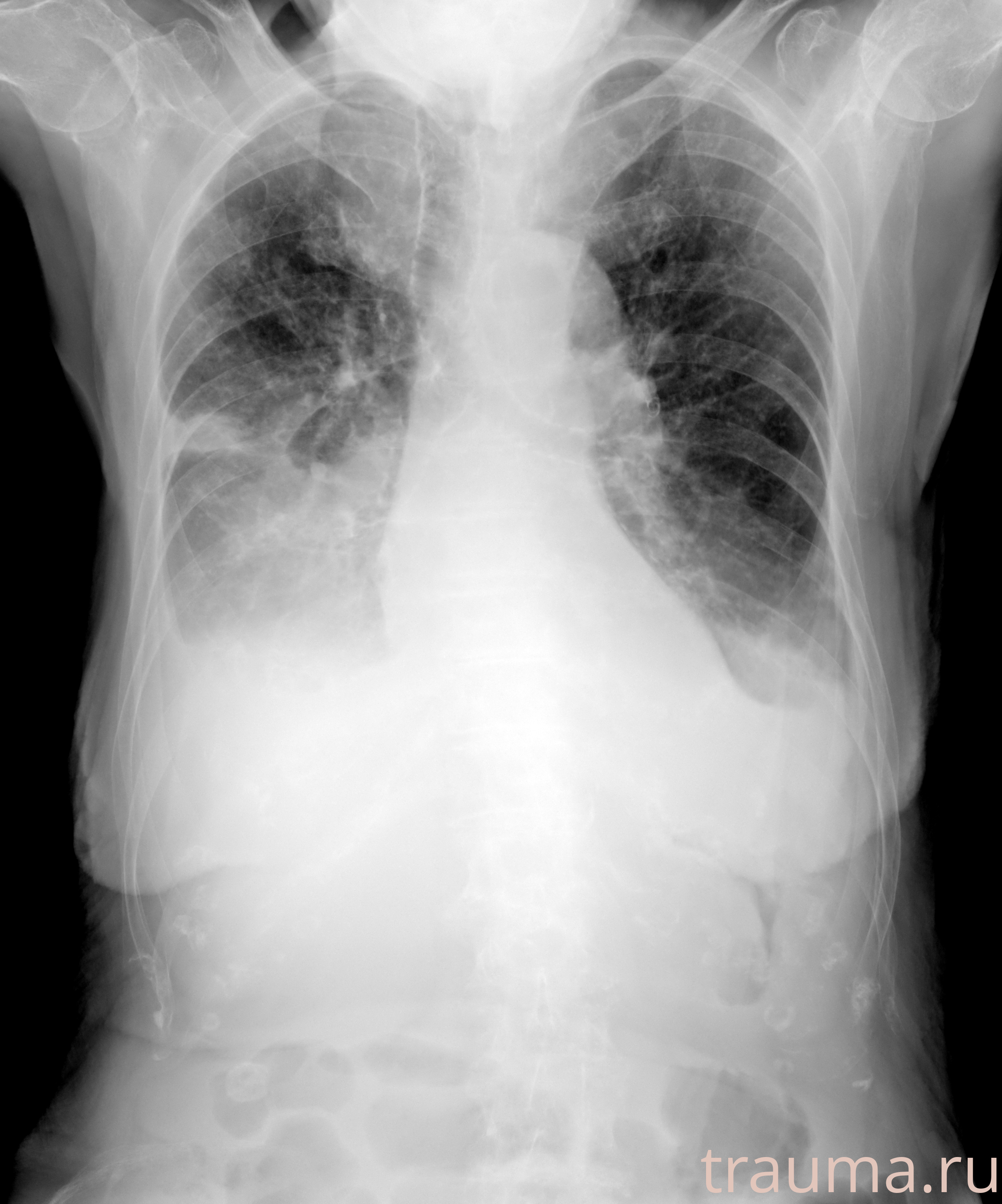 Рентген на дому: по вашему адресу приезжает врач-рентгенолог, травматолог-ортопед с мобильным рентгеновским аппаратом, проводит диагностику травмы или заболевания, делает необходимые рентгенограммы, дает рекомендации по дальнейшему лечению. Получить качественные снимки в домашних условиях возможно благодаря уникальной методике, разработанной МосРентген Центром для института  Склифосовского