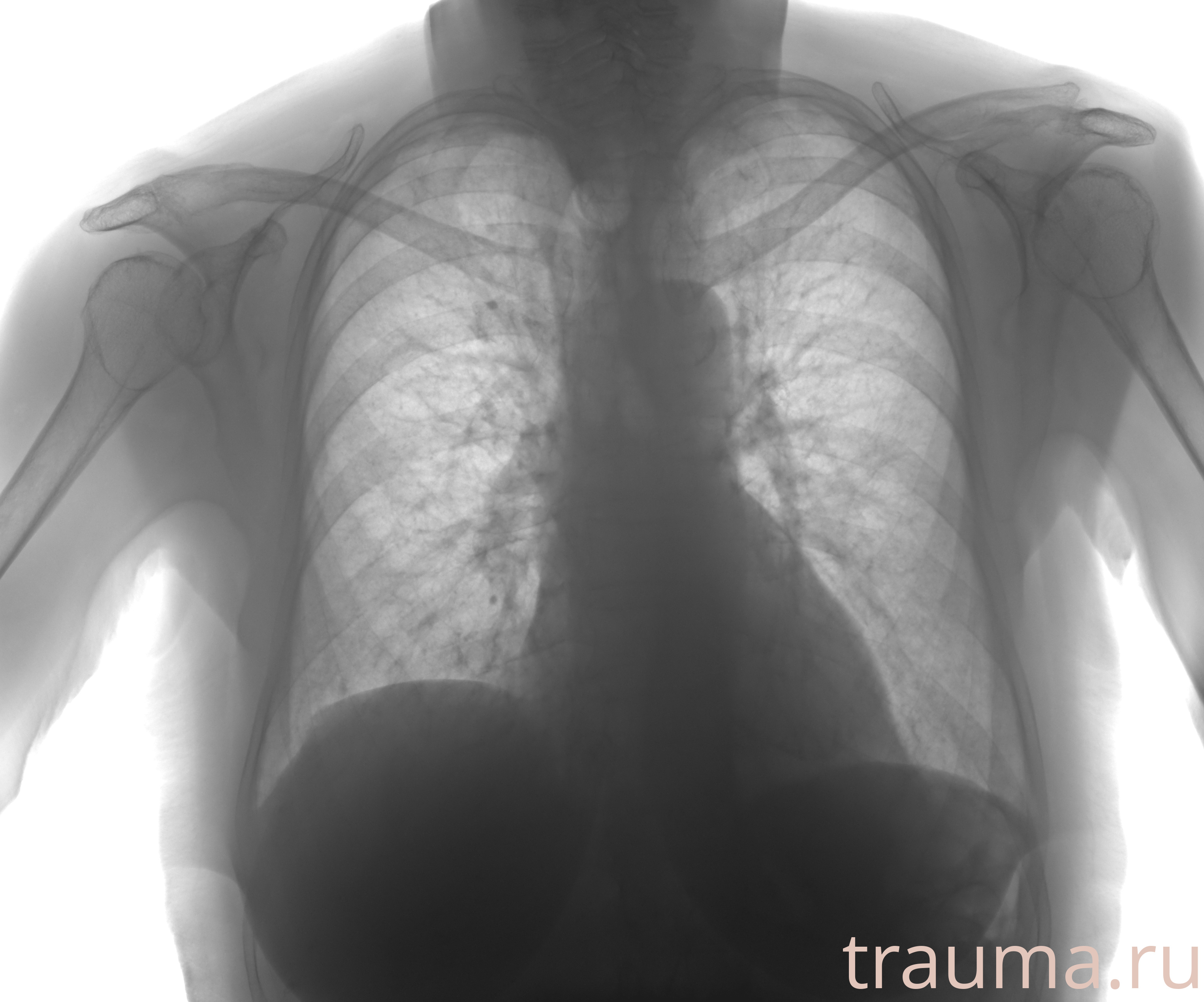 Рентген на дому: по вашему адресу приезжает врач-рентгенолог, травматолог-ортопед с мобильным рентгеновским аппаратом, проводит диагностику травмы или заболевания, делает необходимые рентгенограммы, дает рекомендации по дальнейшему лечению. Получить качественные снимки в домашних условиях возможно благодаря уникальной методике, разработанной МосРентген Центром для института  Склифосовского