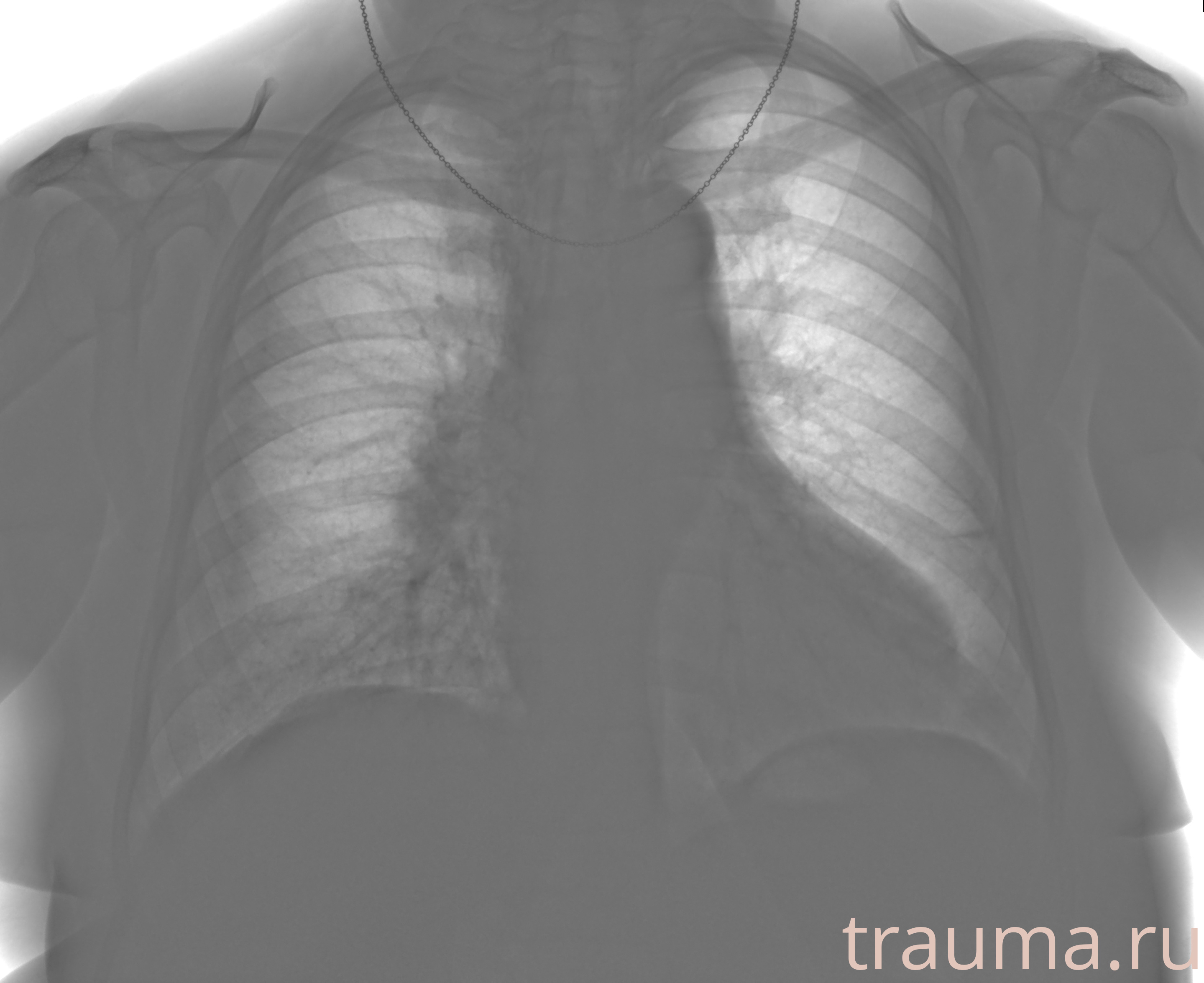 Рентген на дому: по вашему адресу приезжает врач-рентгенолог, травматолог-ортопед с мобильным рентгеновским аппаратом, проводит диагностику травмы или заболевания, делает необходимые рентгенограммы, дает рекомендации по дальнейшему лечению. Получить качественные снимки в домашних условиях возможно благодаря уникальной методике, разработанной МосРентген Центром для института  Склифосовского