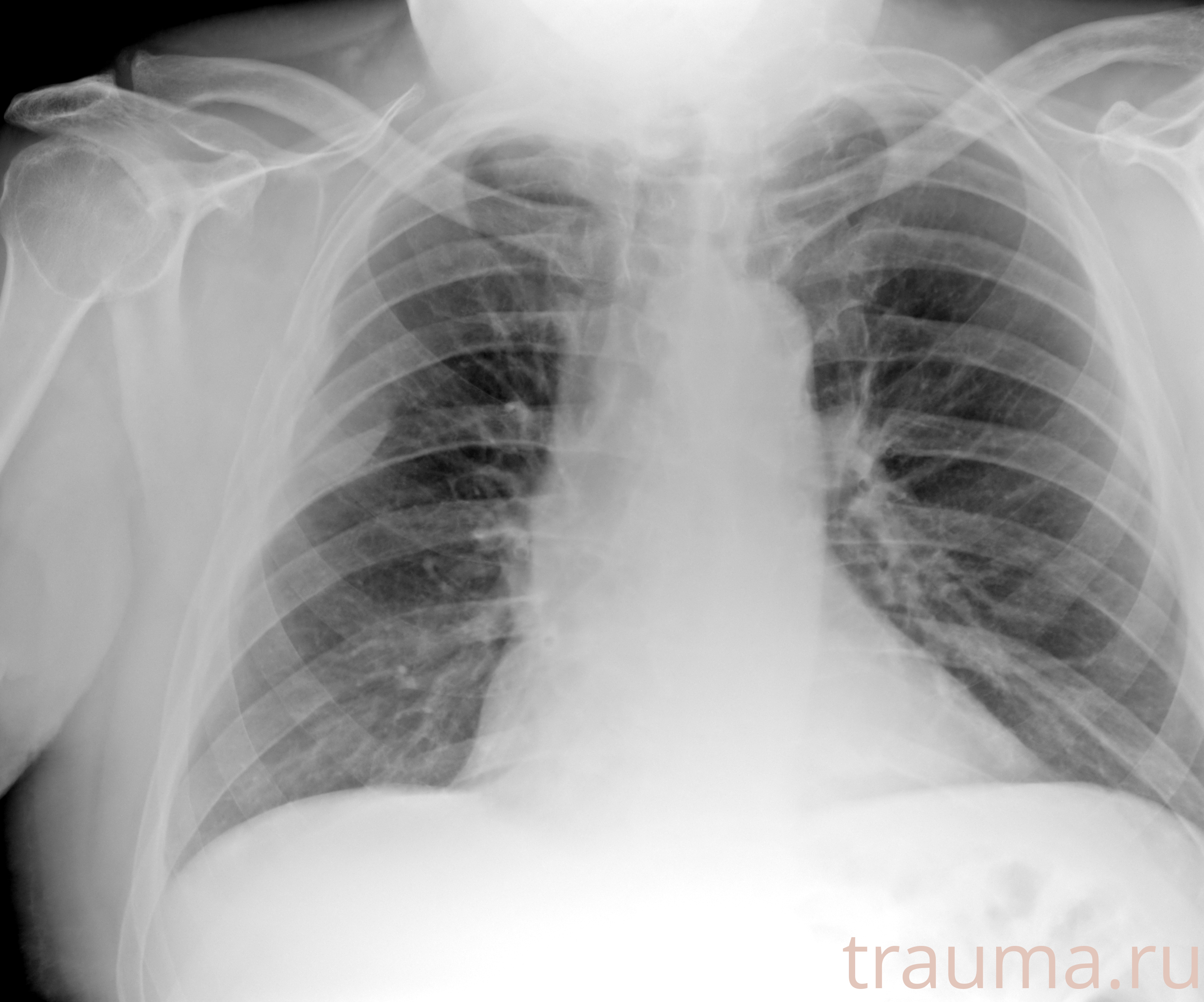 Рентген на дому: по вашему адресу приезжает врач-рентгенолог, травматолог-ортопед с мобильным рентгеновским аппаратом, проводит диагностику травмы или заболевания, делает необходимые рентгенограммы, дает рекомендации по дальнейшему лечению. Получить качественные снимки в домашних условиях возможно благодаря уникальной методике, разработанной МосРентген Центром для института  Склифосовского