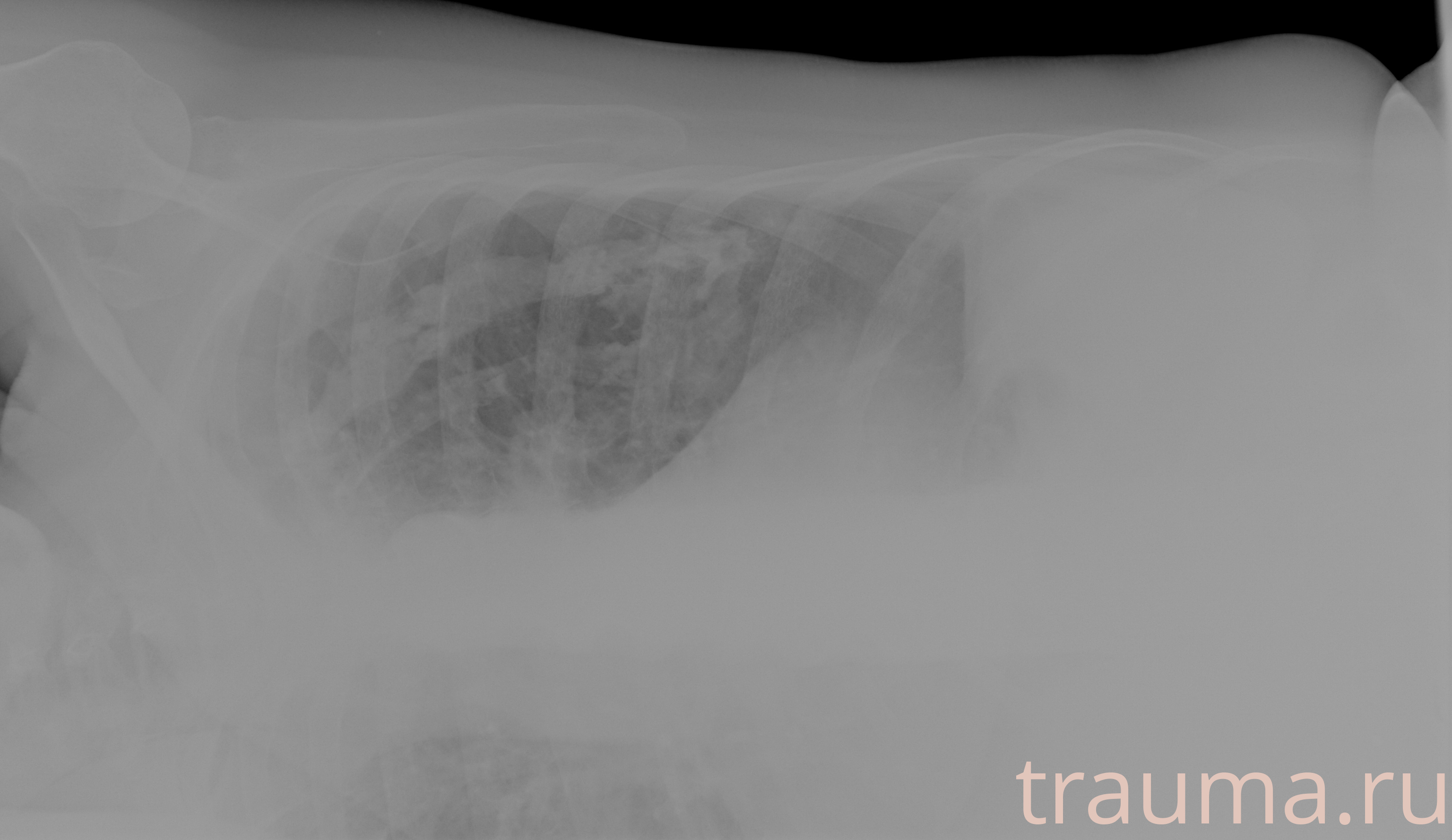 Рентген на дому: по вашему адресу приезжает врач-рентгенолог, травматолог-ортопед с мобильным рентгеновским аппаратом, проводит диагностику травмы или заболевания, делает необходимые рентгенограммы, дает рекомендации по дальнейшему лечению. Получить качественные снимки в домашних условиях возможно благодаря уникальной методике, разработанной МосРентген Центром для института  Склифосовского