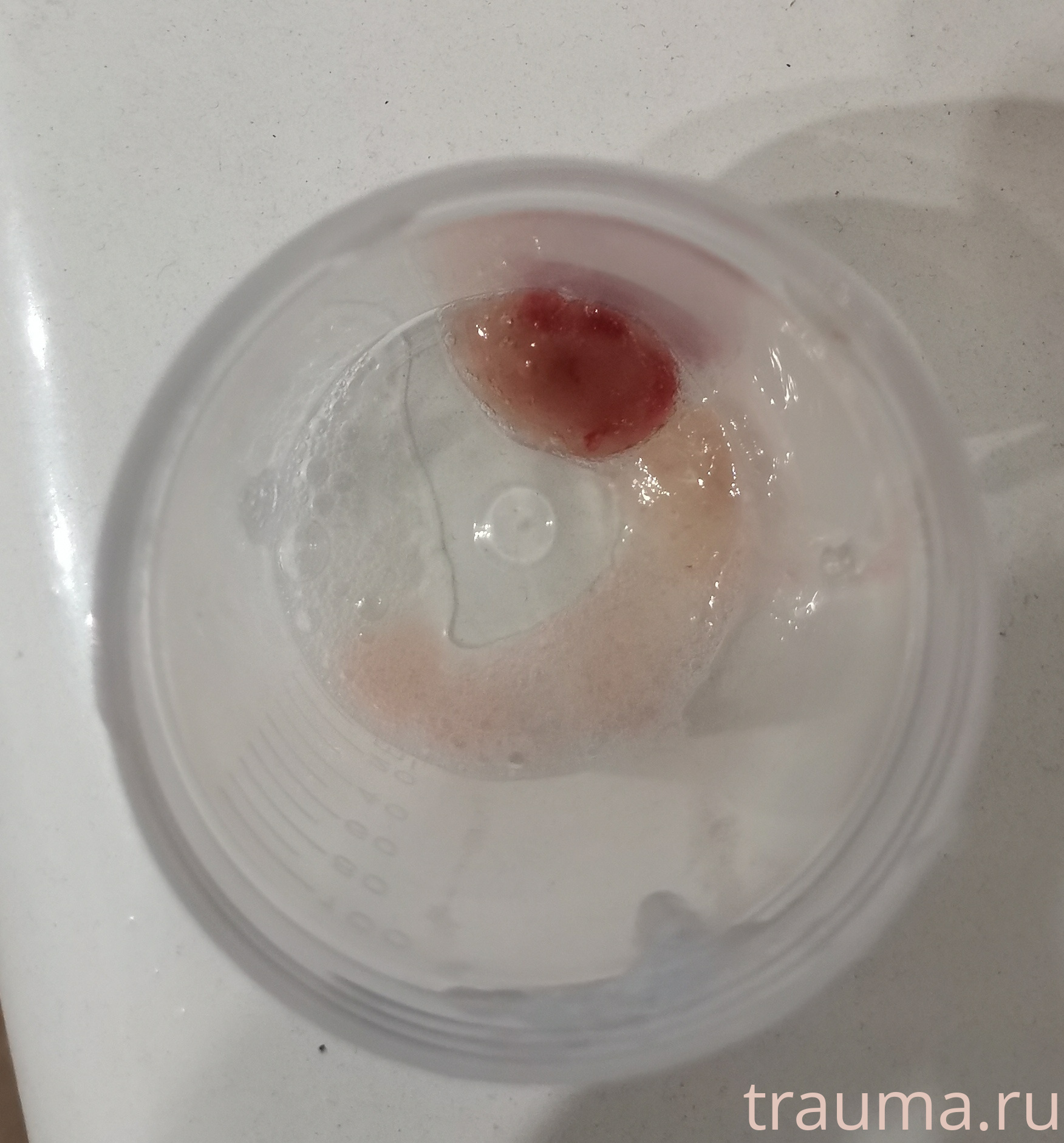 Рентген на дому: по вашему адресу приезжает врач-рентгенолог, травматолог-ортопед с мобильным рентгеновским аппаратом, проводит диагностику травмы или заболевания, делает необходимые рентгенограммы, дает рекомендации по дальнейшему лечению. Получить качественные снимки в домашних условиях возможно благодаря уникальной методике, разработанной МосРентген Центром для института  Склифосовского