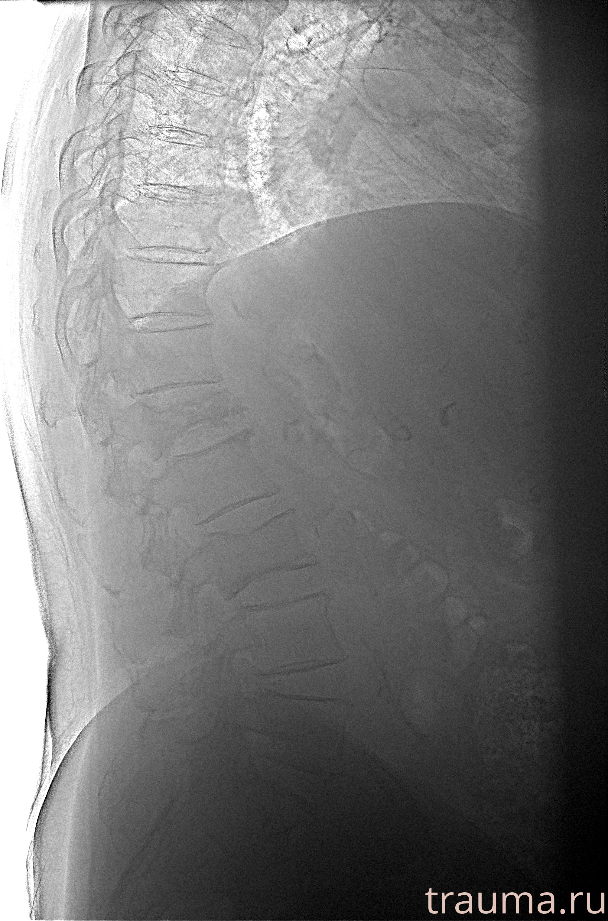 Рентген на дому: по вашему адресу приезжает врач-рентгенолог, травматолог-ортопед с мобильным рентгеновским аппаратом, проводит диагностику травмы или заболевания, делает необходимые рентгенограммы, дает рекомендации по дальнейшему лечению. Получить качественные снимки в домашних условиях возможно благодаря уникальной методике, разработанной МосРентген Центром для института  Склифосовского