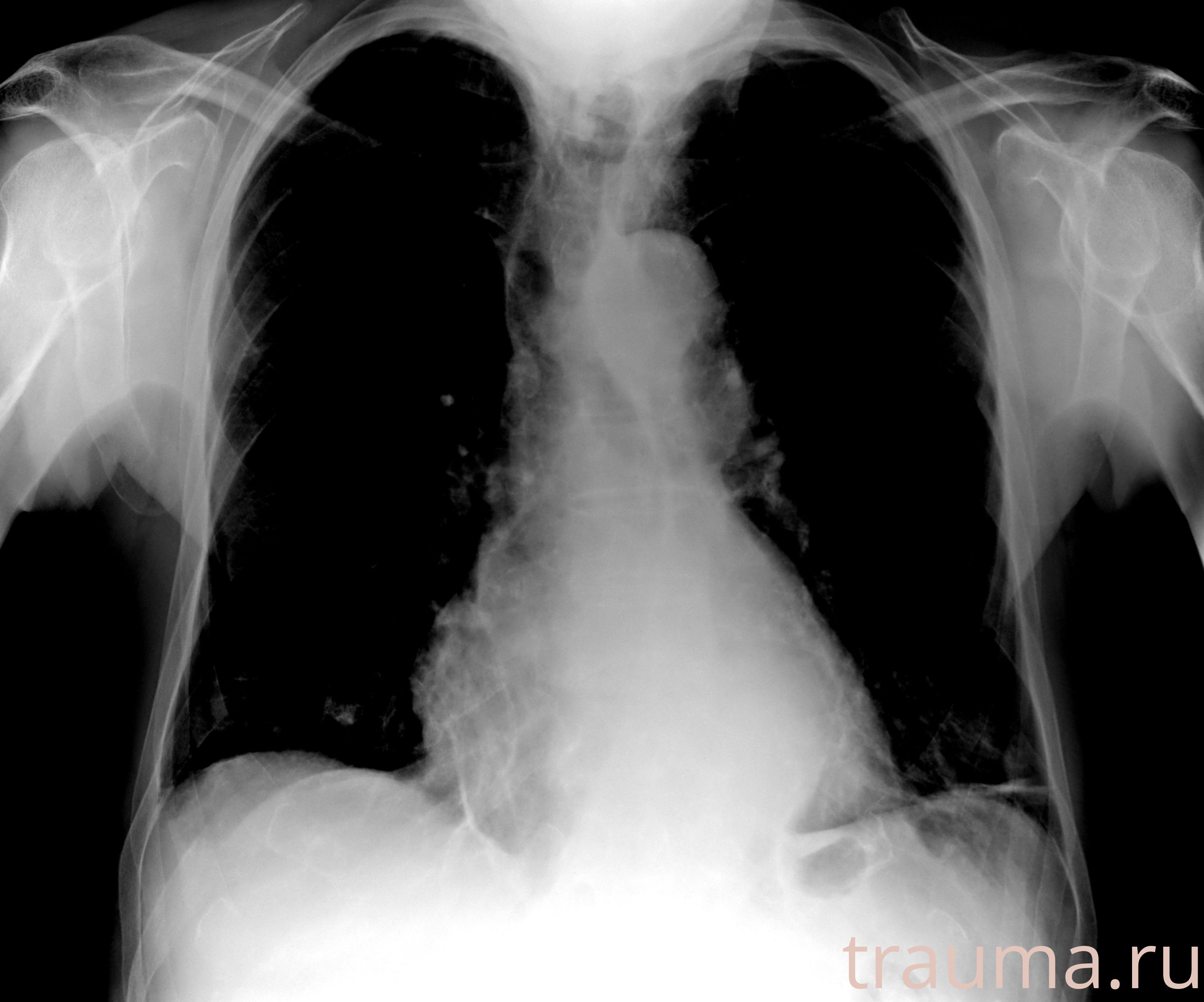 Рентген на дому: по вашему адресу приезжает врач-рентгенолог, травматолог-ортопед с мобильным рентгеновским аппаратом, проводит диагностику травмы или заболевания, делает необходимые рентгенограммы, дает рекомендации по дальнейшему лечению. Получить качественные снимки в домашних условиях возможно благодаря уникальной методике, разработанной МосРентген Центром для института  Склифосовского