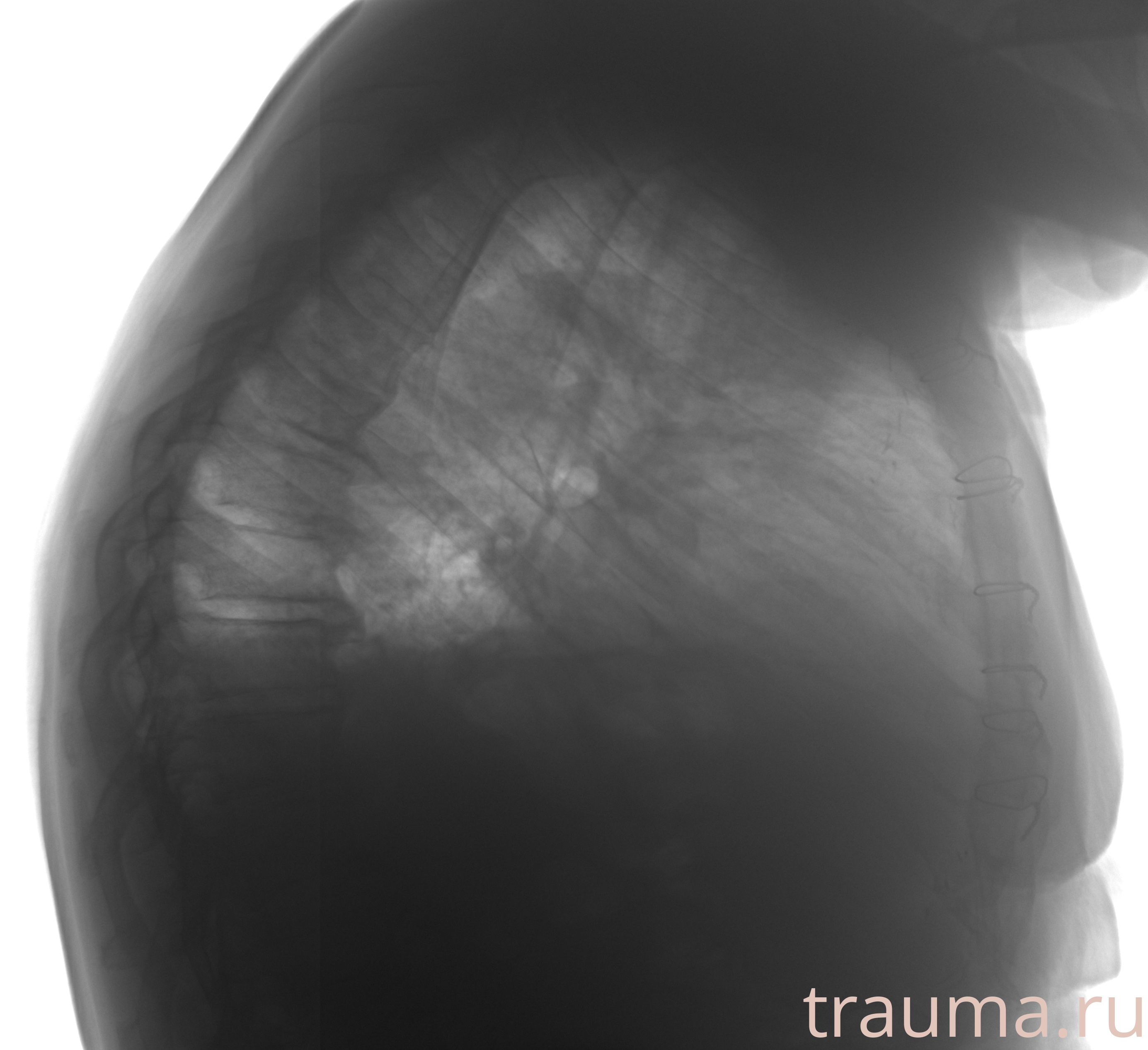 Рентген на дому: по вашему адресу приезжает врач-рентгенолог, травматолог-ортопед с мобильным рентгеновским аппаратом, проводит диагностику травмы или заболевания, делает необходимые рентгенограммы, дает рекомендации по дальнейшему лечению. Получить качественные снимки в домашних условиях возможно благодаря уникальной методике, разработанной МосРентген Центром для института  Склифосовского