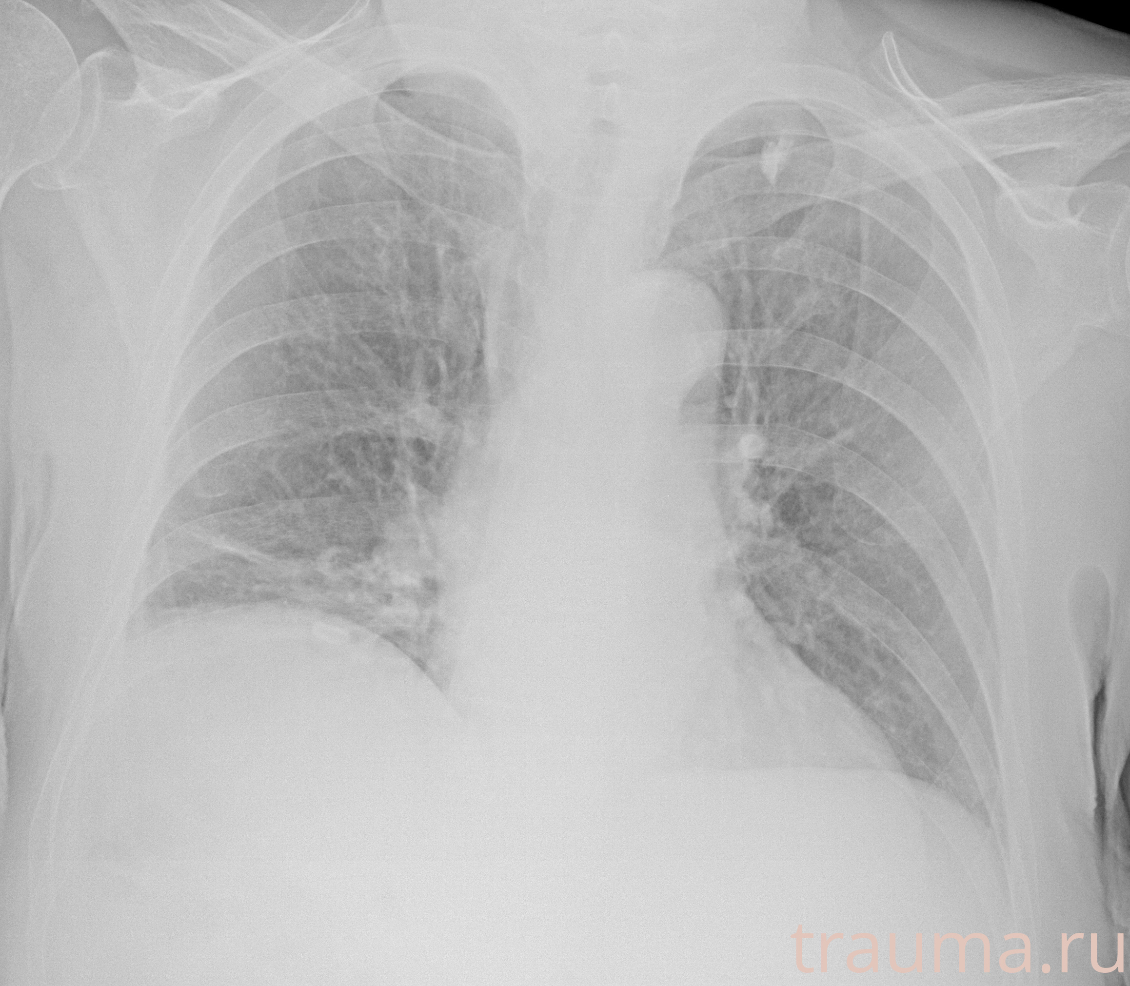 Рентген на дому: по вашему адресу приезжает врач-рентгенолог, травматолог-ортопед с мобильным рентгеновским аппаратом, проводит диагностику травмы или заболевания, делает необходимые рентгенограммы, дает рекомендации по дальнейшему лечению. Получить качественные снимки в домашних условиях возможно благодаря уникальной методике, разработанной МосРентген Центром для института  Склифосовского