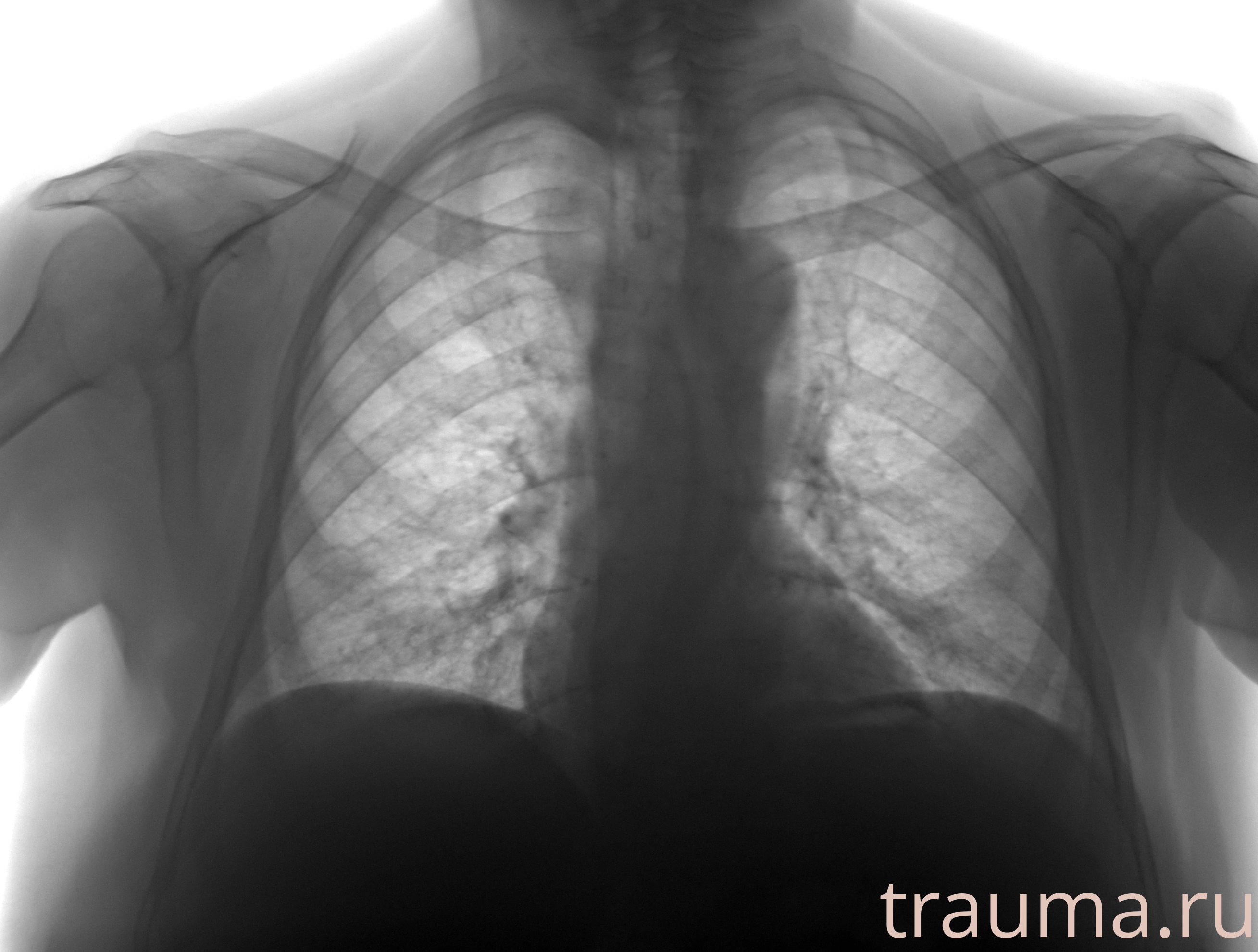 Рентген на дому: по вашему адресу приезжает врач-рентгенолог, травматолог-ортопед с мобильным рентгеновским аппаратом, проводит диагностику травмы или заболевания, делает необходимые рентгенограммы, дает рекомендации по дальнейшему лечению. Получить качественные снимки в домашних условиях возможно благодаря уникальной методике, разработанной МосРентген Центром для института  Склифосовского