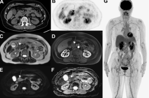 Возможности топографических методов в диагностике нейкроцистицеркоза: обзор