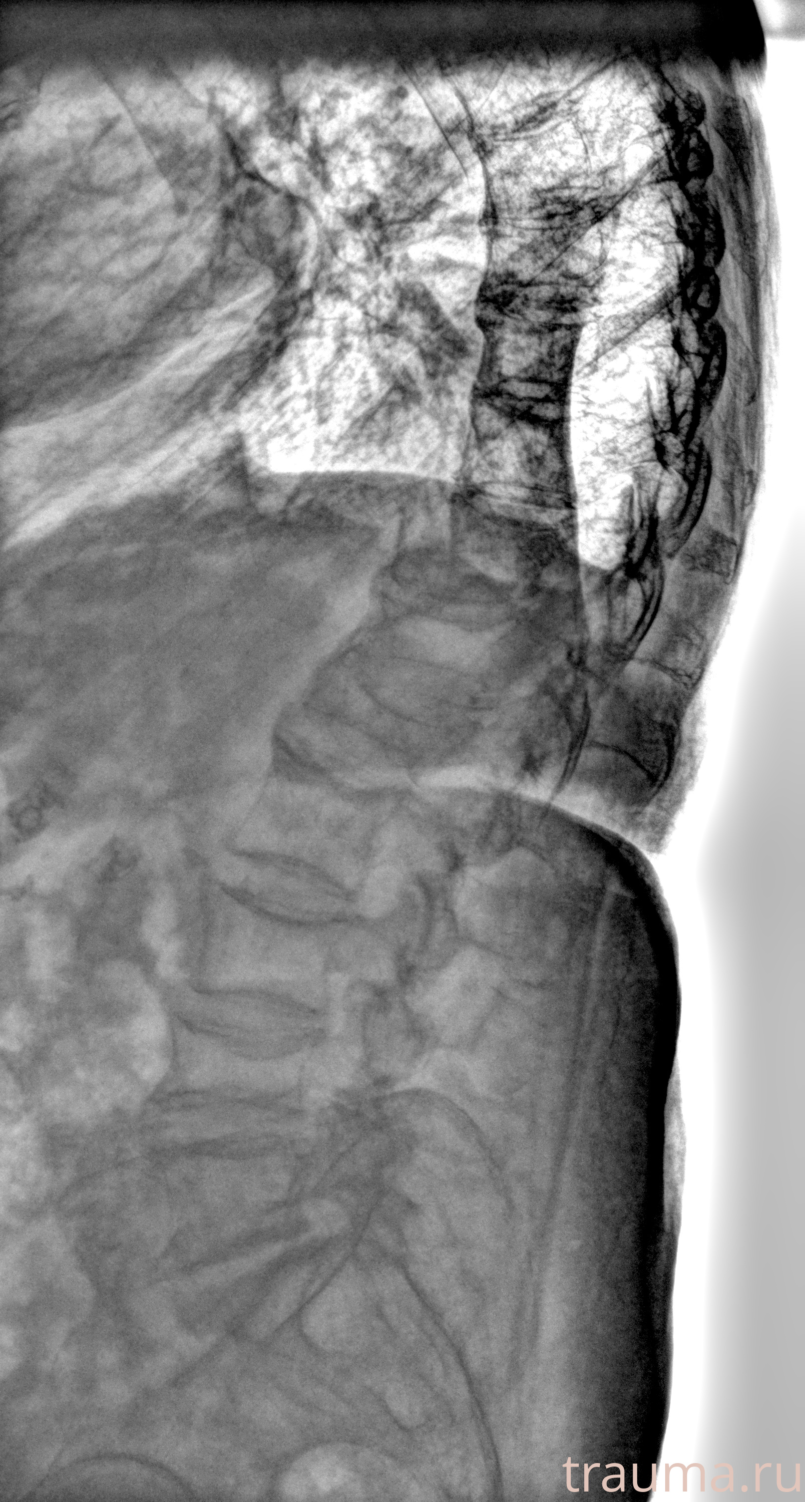 Рентген на дому: по вашему адресу приезжает врач-рентгенолог, травматолог-ортопед с мобильным рентгеновским аппаратом, проводит диагностику травмы или заболевания, делает необходимые рентгенограммы, дает рекомендации по дальнейшему лечению. Получить качественные снимки в домашних условиях возможно благодаря уникальной методике, разработанной МосРентген Центром для института  Склифосовского