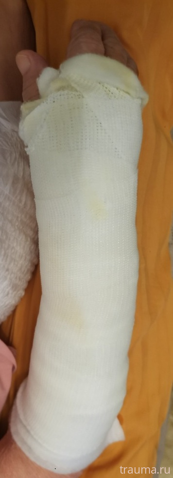 Рентген на дому: по вашему адресу приезжает врач-рентгенолог, травматолог-ортопед с мобильным рентгеновским аппаратом, проводит диагностику травмы или заболевания, делает необходимые рентгенограммы, дает рекомендации по дальнейшему лечению. Получить качественные снимки в домашних условиях возможно благодаря уникальной методике, разработанной МосРентген Центром для института  Склифосовского