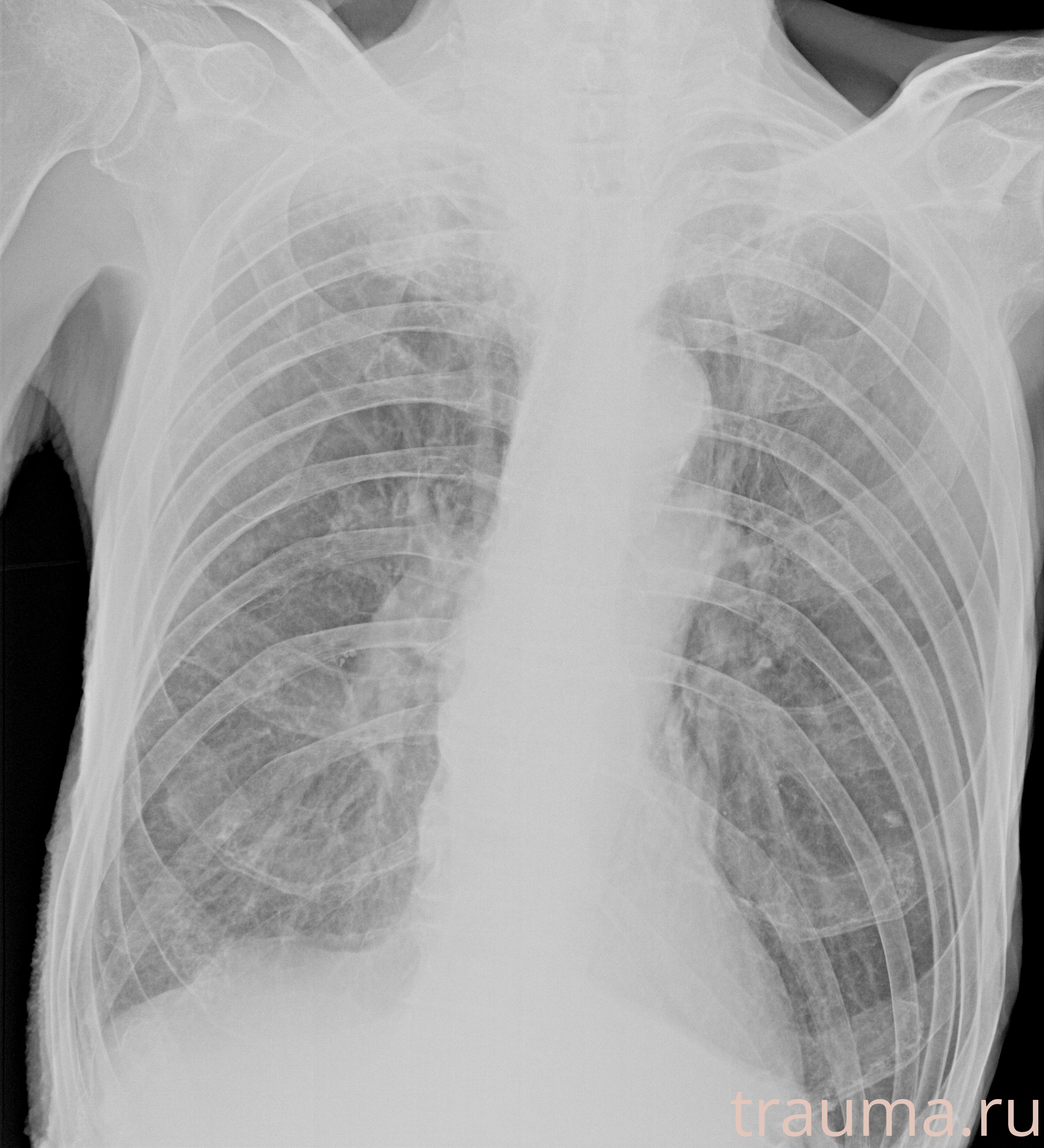 Рентген на дому: по вашему адресу приезжает врач-рентгенолог, травматолог-ортопед с мобильным рентгеновским аппаратом, проводит диагностику травмы или заболевания, делает необходимые рентгенограммы, дает рекомендации по дальнейшему лечению. Получить качественные снимки в домашних условиях возможно благодаря уникальной методике, разработанной МосРентген Центром для института  Склифосовского