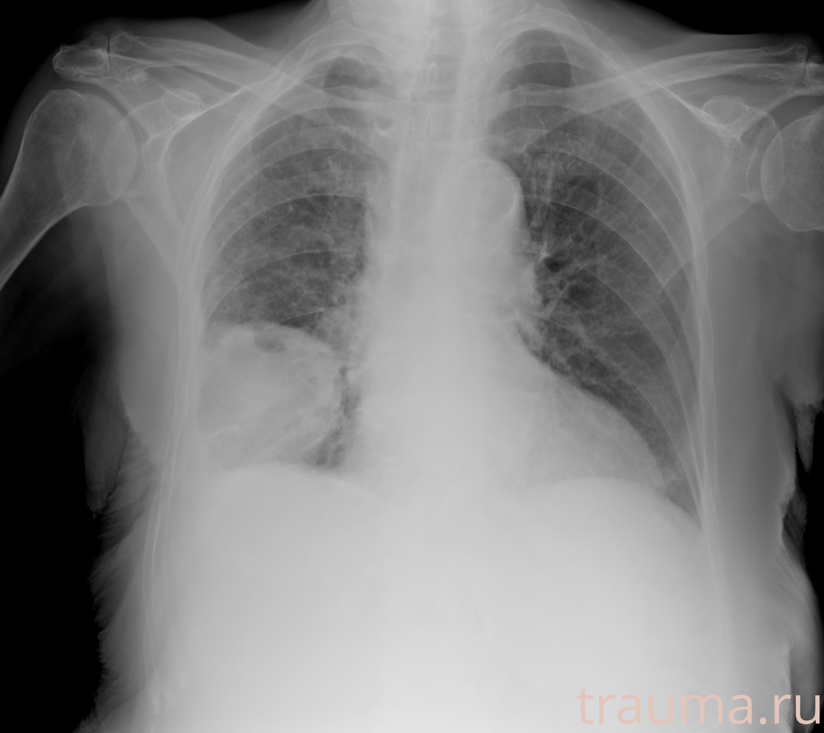 Рентген на дому: по вашему адресу приезжает врач-рентгенолог, травматолог-ортопед с мобильным рентгеновским аппаратом, проводит диагностику травмы или заболевания, делает необходимые рентгенограммы, дает рекомендации по дальнейшему лечению. Получить качественные снимки в домашних условиях возможно благодаря уникальной методике, разработанной МосРентген Центром для института  Склифосовского