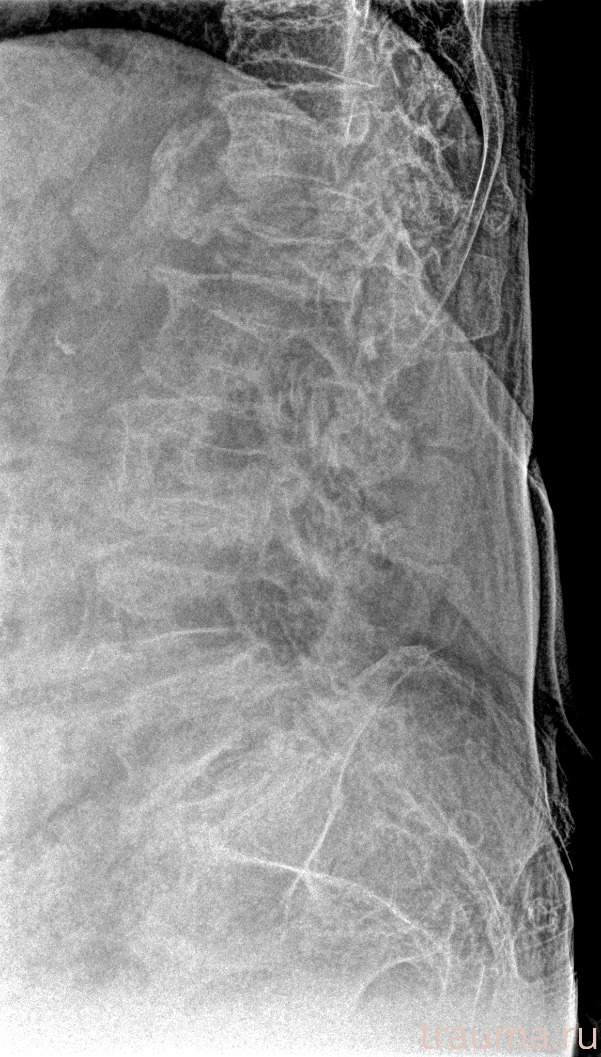 Рентген на дому: по вашему адресу приезжает врач-рентгенолог, травматолог-ортопед с мобильным рентгеновским аппаратом, проводит диагностику травмы или заболевания, делает необходимые рентгенограммы, дает рекомендации по дальнейшему лечению. Получить качественные снимки в домашних условиях возможно благодаря уникальной методике, разработанной МосРентген Центром для института  Склифосовского