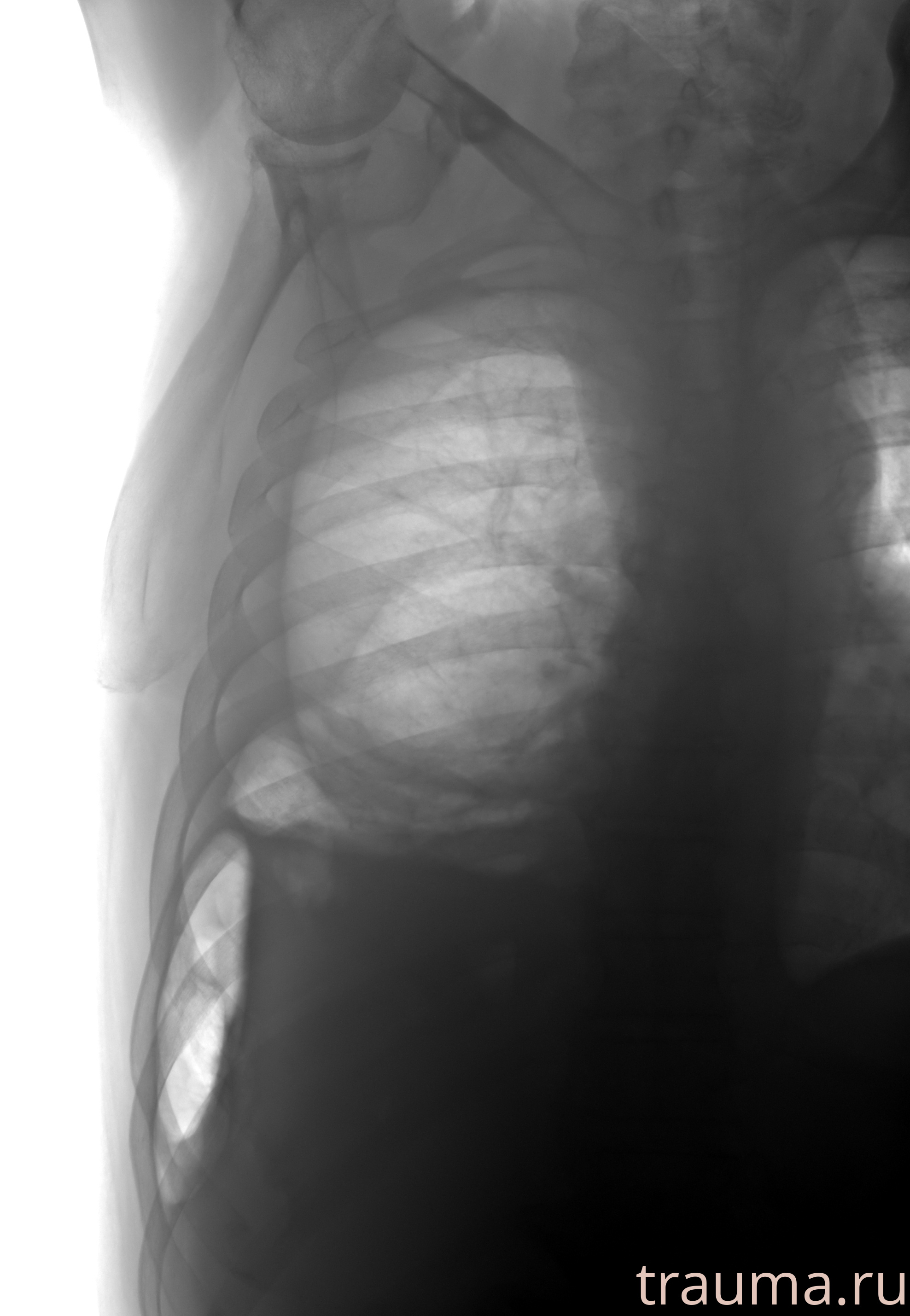 Рентген на дому: по вашему адресу приезжает врач-рентгенолог, травматолог-ортопед с мобильным рентгеновским аппаратом, проводит диагностику травмы или заболевания, делает необходимые рентгенограммы, дает рекомендации по дальнейшему лечению. Получить качественные снимки в домашних условиях возможно благодаря уникальной методике, разработанной МосРентген Центром для института  Склифосовского