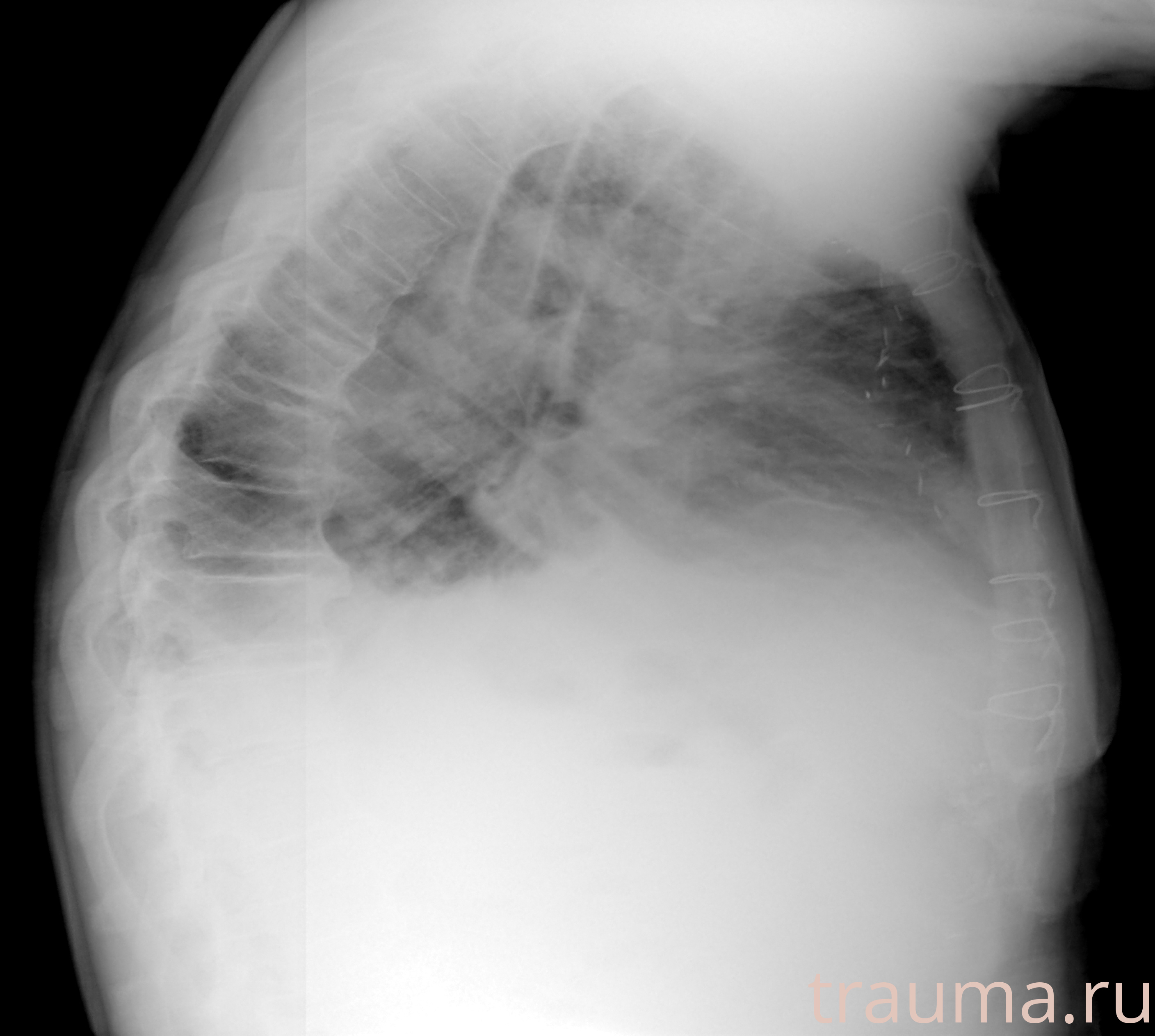 Рентген на дому: по вашему адресу приезжает врач-рентгенолог, травматолог-ортопед с мобильным рентгеновским аппаратом, проводит диагностику травмы или заболевания, делает необходимые рентгенограммы, дает рекомендации по дальнейшему лечению. Получить качественные снимки в домашних условиях возможно благодаря уникальной методике, разработанной МосРентген Центром для института  Склифосовского