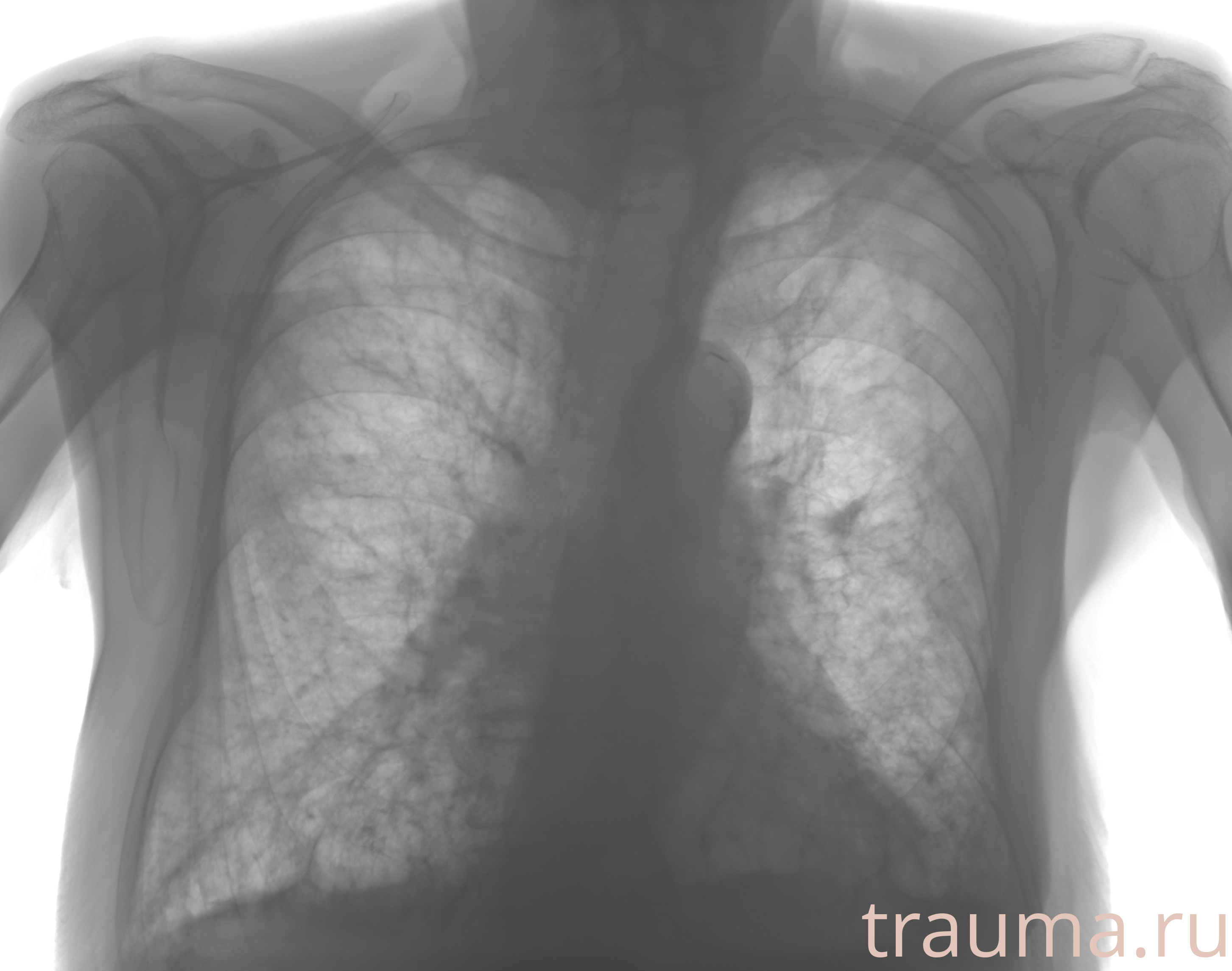 Рентген на дому: по вашему адресу приезжает врач-рентгенолог, травматолог-ортопед с мобильным рентгеновским аппаратом, проводит диагностику травмы или заболевания, делает необходимые рентгенограммы, дает рекомендации по дальнейшему лечению. Получить качественные снимки в домашних условиях возможно благодаря уникальной методике, разработанной МосРентген Центром для института  Склифосовского