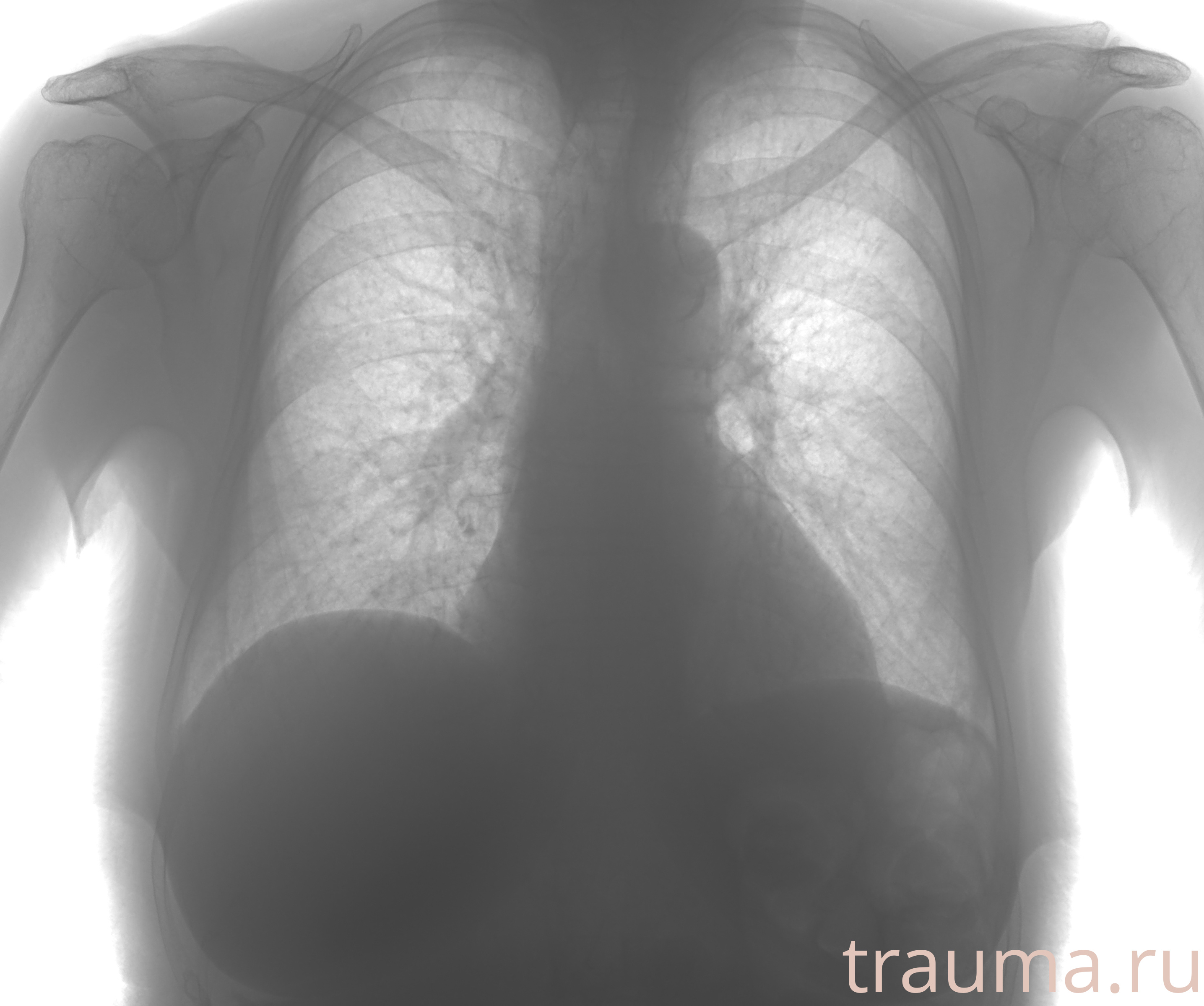 Рентген на дому: по вашему адресу приезжает врач-рентгенолог, травматолог-ортопед с мобильным рентгеновским аппаратом, проводит диагностику травмы или заболевания, делает необходимые рентгенограммы, дает рекомендации по дальнейшему лечению. Получить качественные снимки в домашних условиях возможно благодаря уникальной методике, разработанной МосРентген Центром для института  Склифосовского