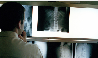 Производительность столичных рентгенологов благодаря телемедицине повысилась вдвое
