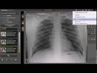 Список приема пациентов PACS в Веб-просмотрщике в программе для цифровой рентгенографии Image Suite