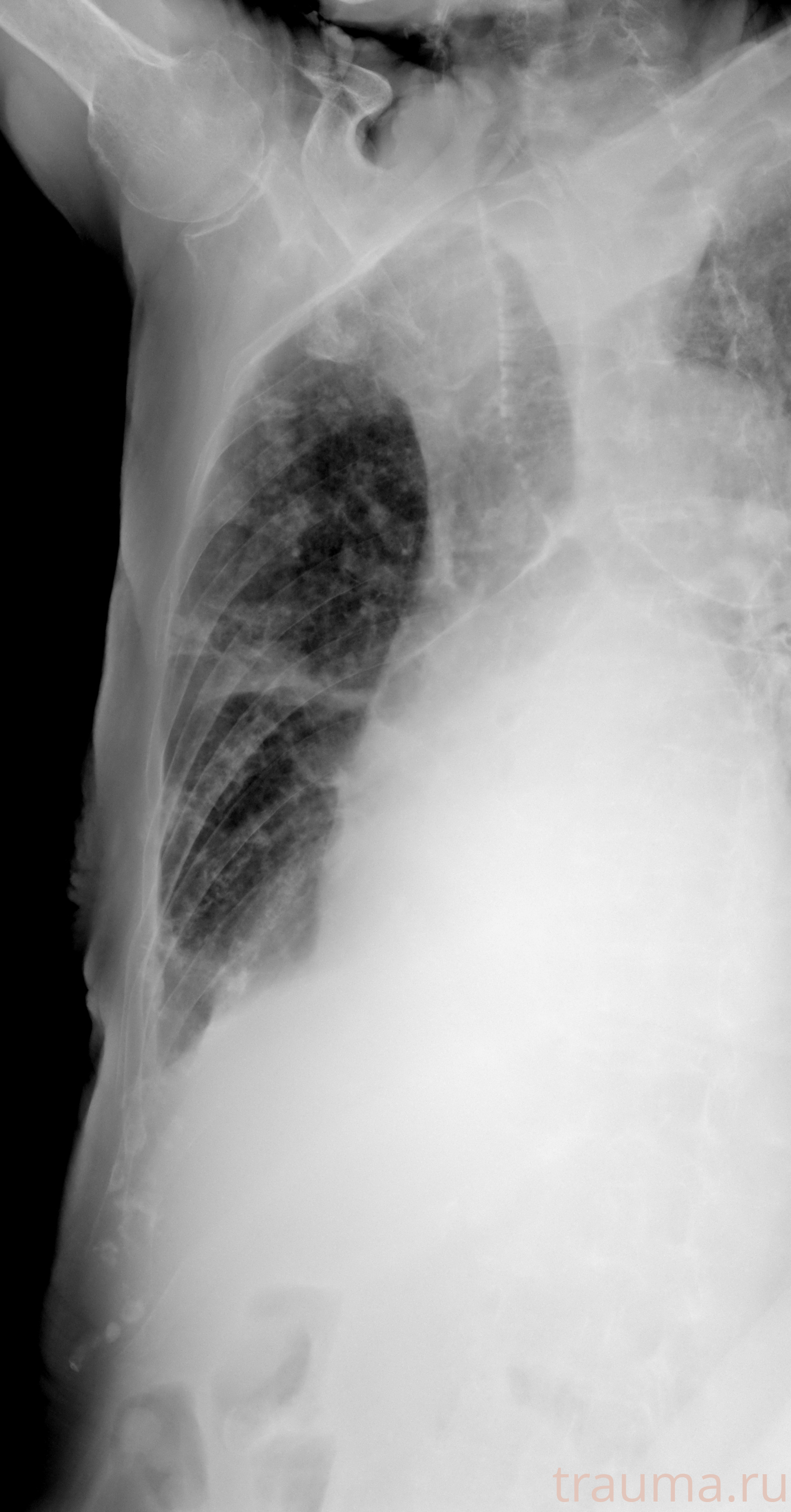 Рентген на дому: по вашему адресу приезжает врач-рентгенолог, травматолог-ортопед с мобильным рентгеновским аппаратом, проводит диагностику травмы или заболевания, делает необходимые рентгенограммы, дает рекомендации по дальнейшему лечению. Получить качественные снимки в домашних условиях возможно благодаря уникальной методике, разработанной МосРентген Центром для института  Склифосовского