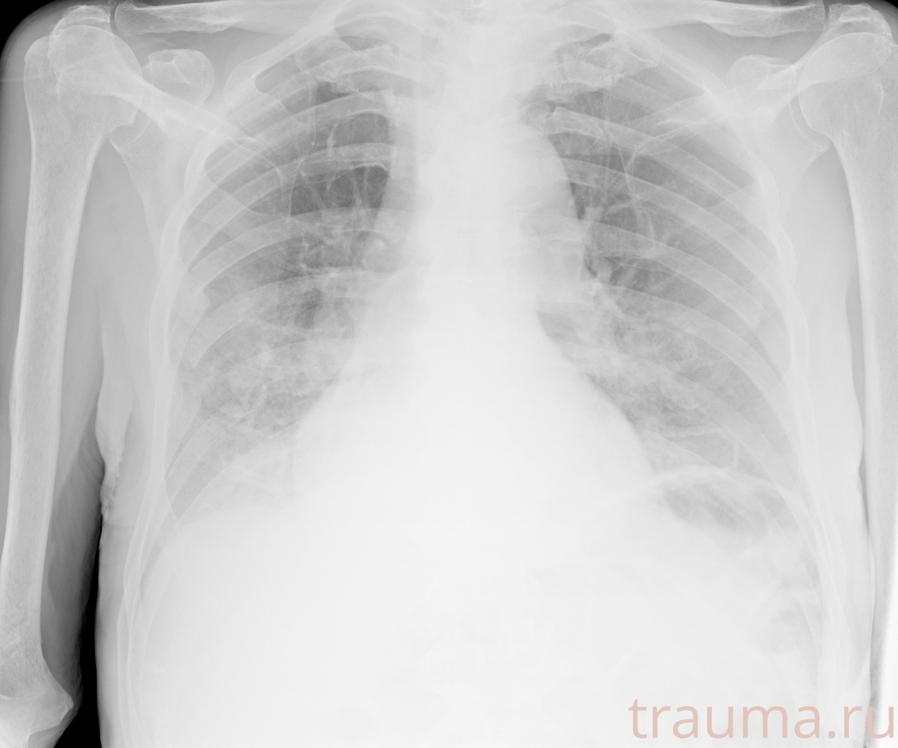 Рентген на дому: по вашему адресу приезжает врач-рентгенолог, травматолог-ортопед с мобильным рентгеновским аппаратом, проводит диагностику травмы или заболевания, делает необходимые рентгенограммы, дает рекомендации по дальнейшему лечению. Получить качественные снимки в домашних условиях возможно благодаря уникальной методике, разработанной МосРентген Центром для института  Склифосовского