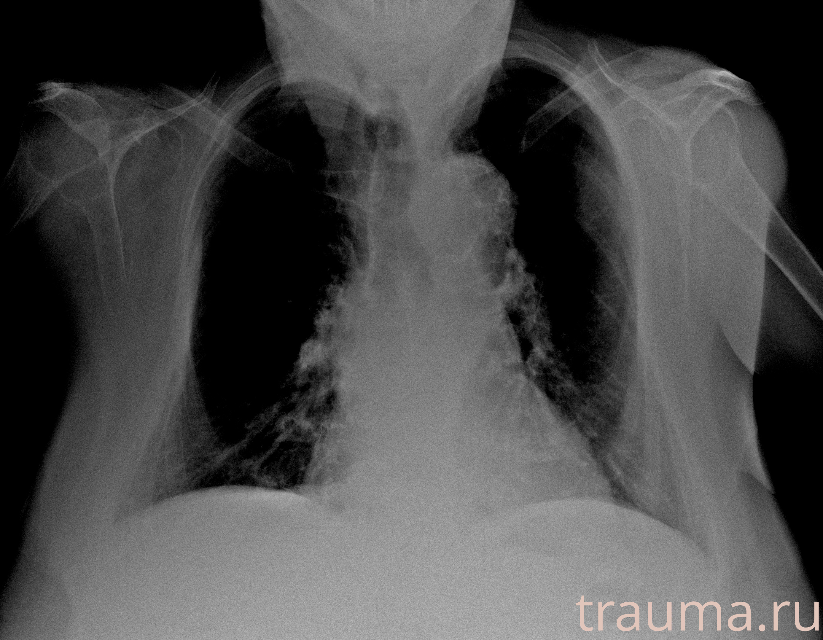 Рентген на дому: по вашему адресу приезжает врач-рентгенолог, травматолог-ортопед с мобильным рентгеновским аппаратом, проводит диагностику травмы или заболевания, делает необходимые рентгенограммы, дает рекомендации по дальнейшему лечению. Получить качественные снимки в домашних условиях возможно благодаря уникальной методике, разработанной МосРентген Центром для института  Склифосовского