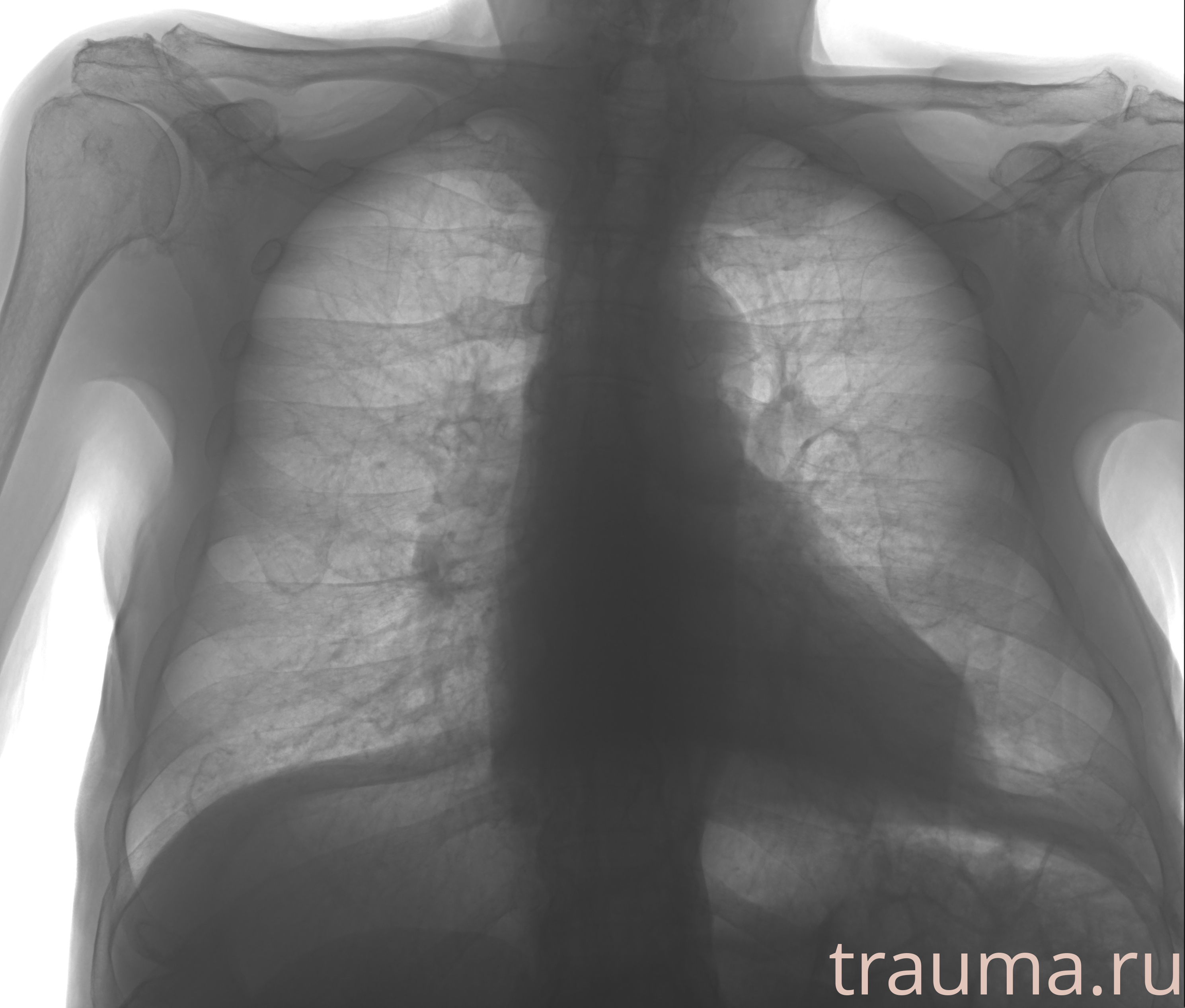 Рентген на дому: по вашему адресу приезжает врач-рентгенолог, травматолог-ортопед с мобильным рентгеновским аппаратом, проводит диагностику травмы или заболевания, делает необходимые рентгенограммы, дает рекомендации по дальнейшему лечению. Получить качественные снимки в домашних условиях возможно благодаря уникальной методике, разработанной МосРентген Центром для института  Склифосовского