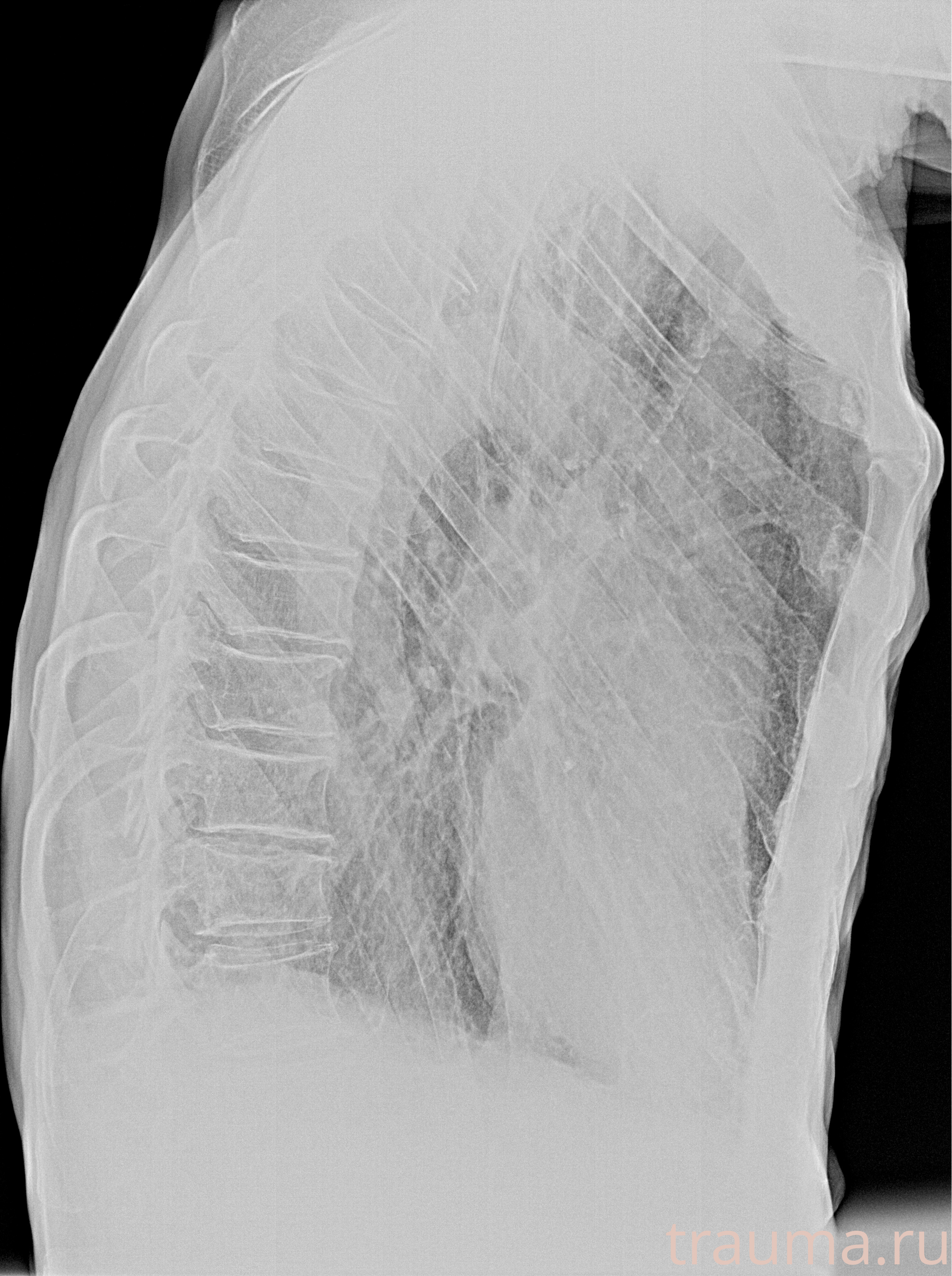Рентген на дому: по вашему адресу приезжает врач-рентгенолог, травматолог-ортопед с мобильным рентгеновским аппаратом, проводит диагностику травмы или заболевания, делает необходимые рентгенограммы, дает рекомендации по дальнейшему лечению. Получить качественные снимки в домашних условиях возможно благодаря уникальной методике, разработанной МосРентген Центром для института  Склифосовского