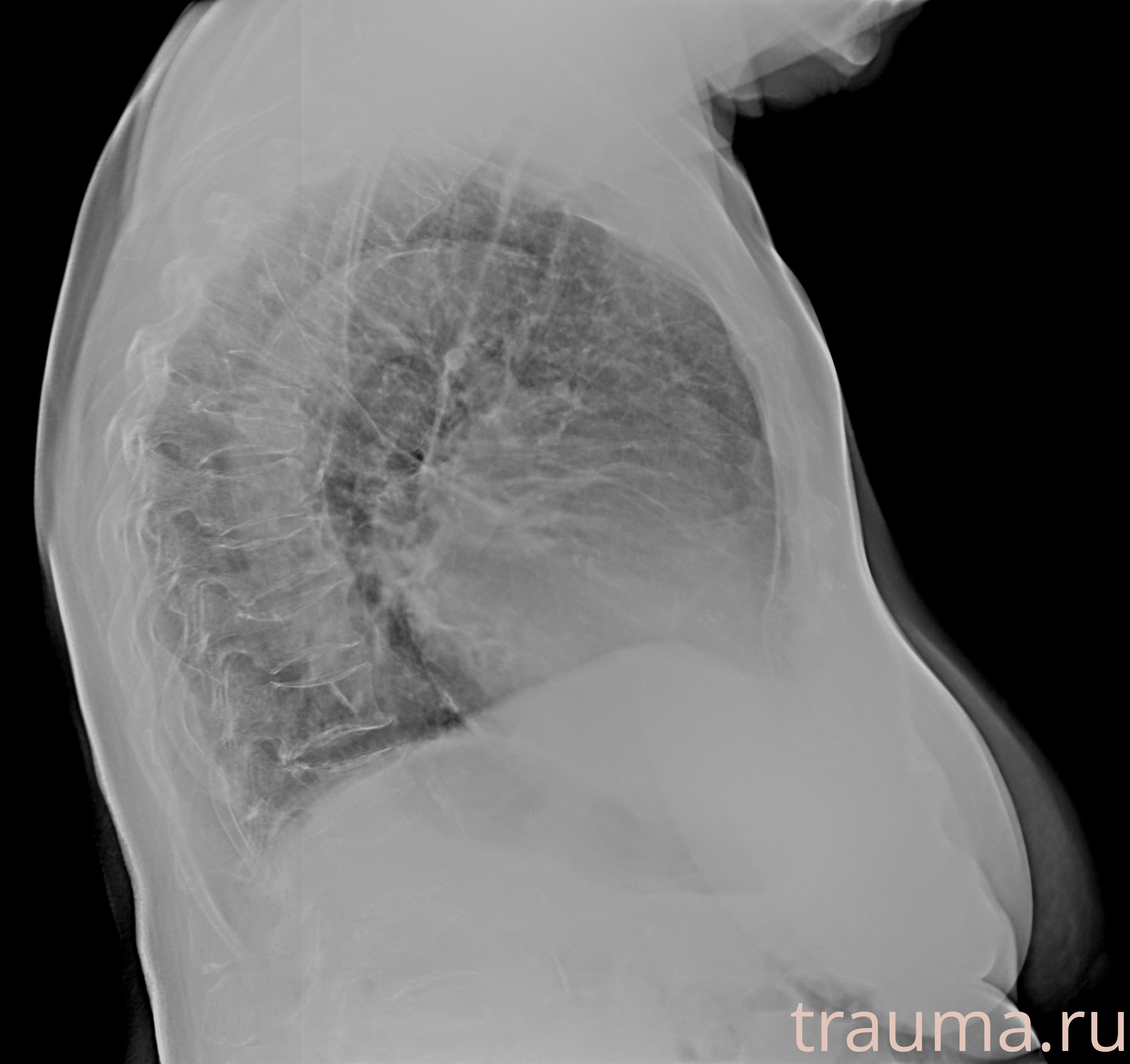 Рентген на дому: по вашему адресу приезжает врач-рентгенолог, травматолог-ортопед с мобильным рентгеновским аппаратом, проводит диагностику травмы или заболевания, делает необходимые рентгенограммы, дает рекомендации по дальнейшему лечению. Получить качественные снимки в домашних условиях возможно благодаря уникальной методике, разработанной МосРентген Центром для института  Склифосовского