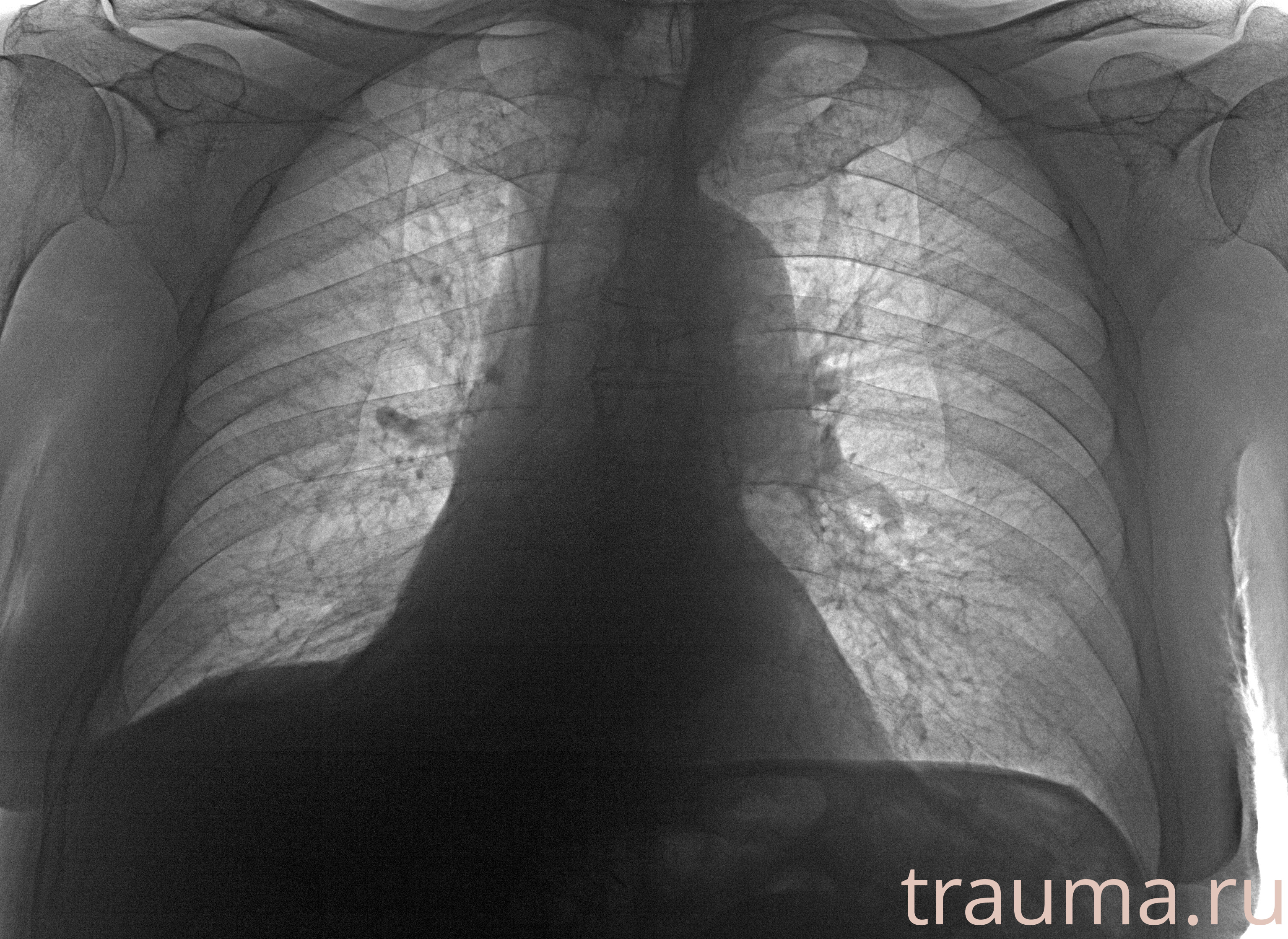 Рентген на дому: по вашему адресу приезжает врач-рентгенолог, травматолог-ортопед с мобильным рентгеновским аппаратом, проводит диагностику травмы или заболевания, делает необходимые рентгенограммы, дает рекомендации по дальнейшему лечению. Получить качественные снимки в домашних условиях возможно благодаря уникальной методике, разработанной МосРентген Центром для института  Склифосовского