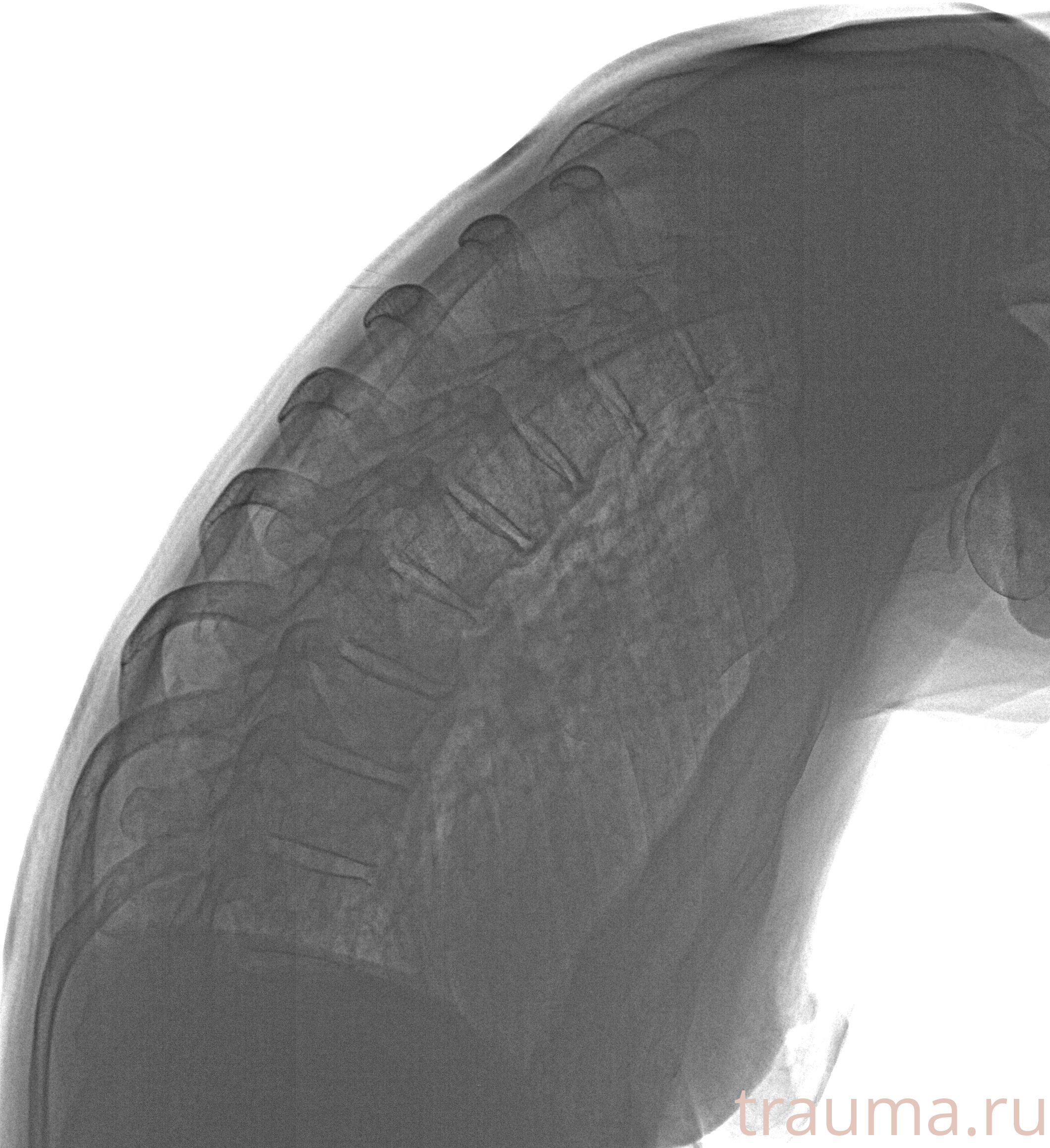 Рентген на дому: по вашему адресу приезжает врач-рентгенолог, травматолог-ортопед с мобильным рентгеновским аппаратом, проводит диагностику травмы или заболевания, делает необходимые рентгенограммы, дает рекомендации по дальнейшему лечению. Получить качественные снимки в домашних условиях возможно благодаря уникальной методике, разработанной МосРентген Центром для института  Склифосовского