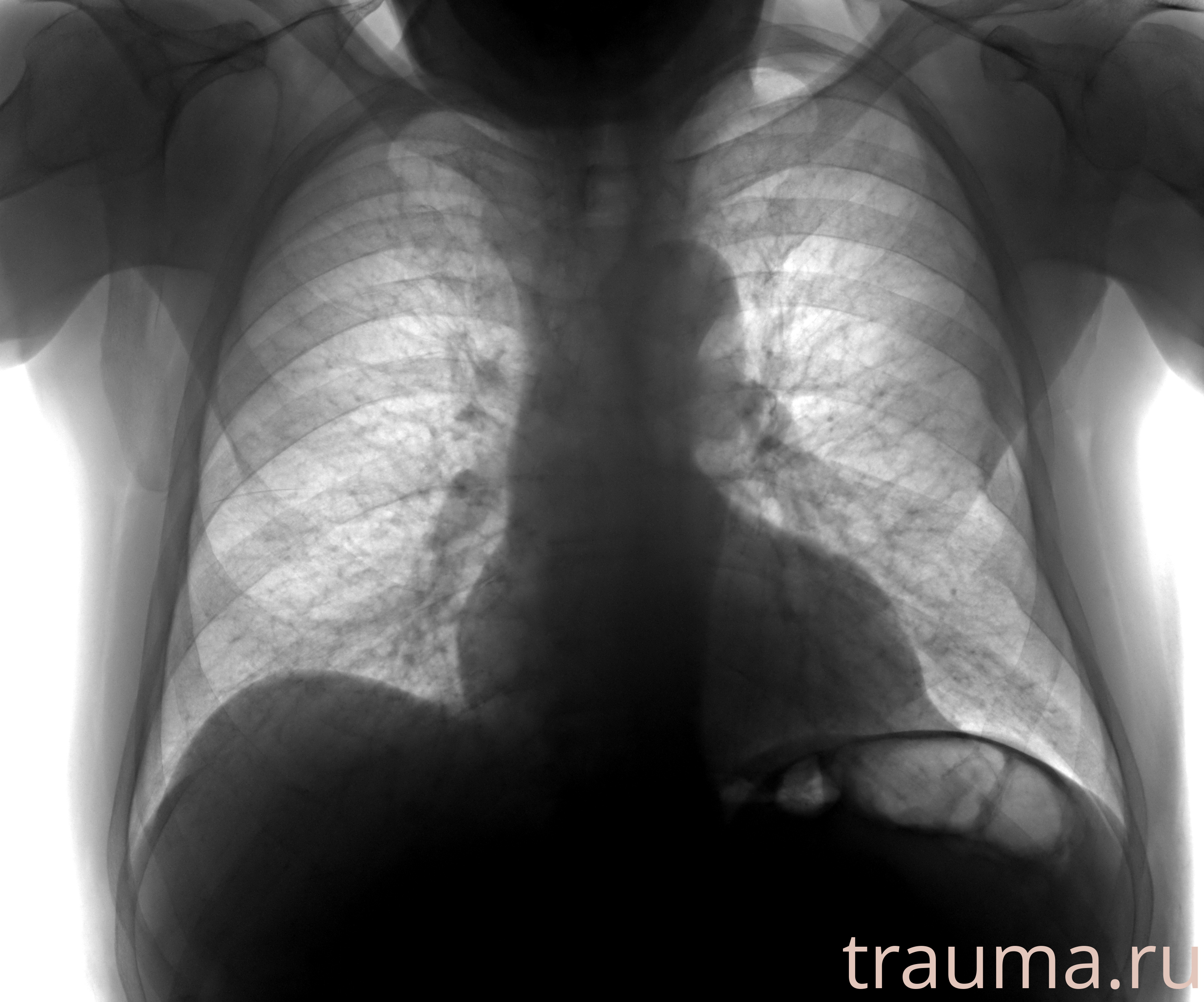 Рентген на дому: по вашему адресу приезжает врач-рентгенолог, травматолог-ортопед с мобильным рентгеновским аппаратом, проводит диагностику травмы или заболевания, делает необходимые рентгенограммы, дает рекомендации по дальнейшему лечению. Получить качественные снимки в домашних условиях возможно благодаря уникальной методике, разработанной МосРентген Центром для института  Склифосовского