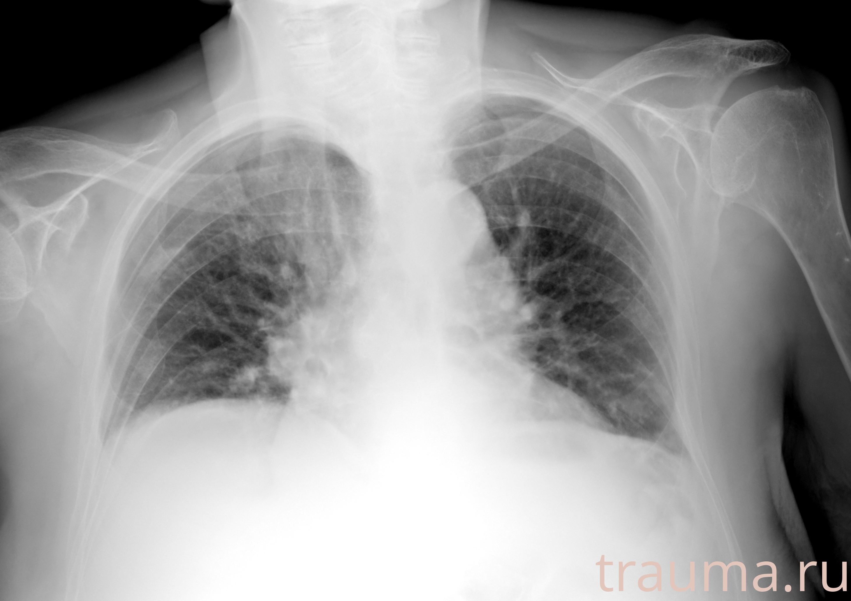 Рентген на дому: по вашему адресу приезжает врач-рентгенолог, травматолог-ортопед с мобильным рентгеновским аппаратом, проводит диагностику травмы или заболевания, делает необходимые рентгенограммы, дает рекомендации по дальнейшему лечению. Получить качественные снимки в домашних условиях возможно благодаря уникальной методике, разработанной МосРентген Центром для института  Склифосовского