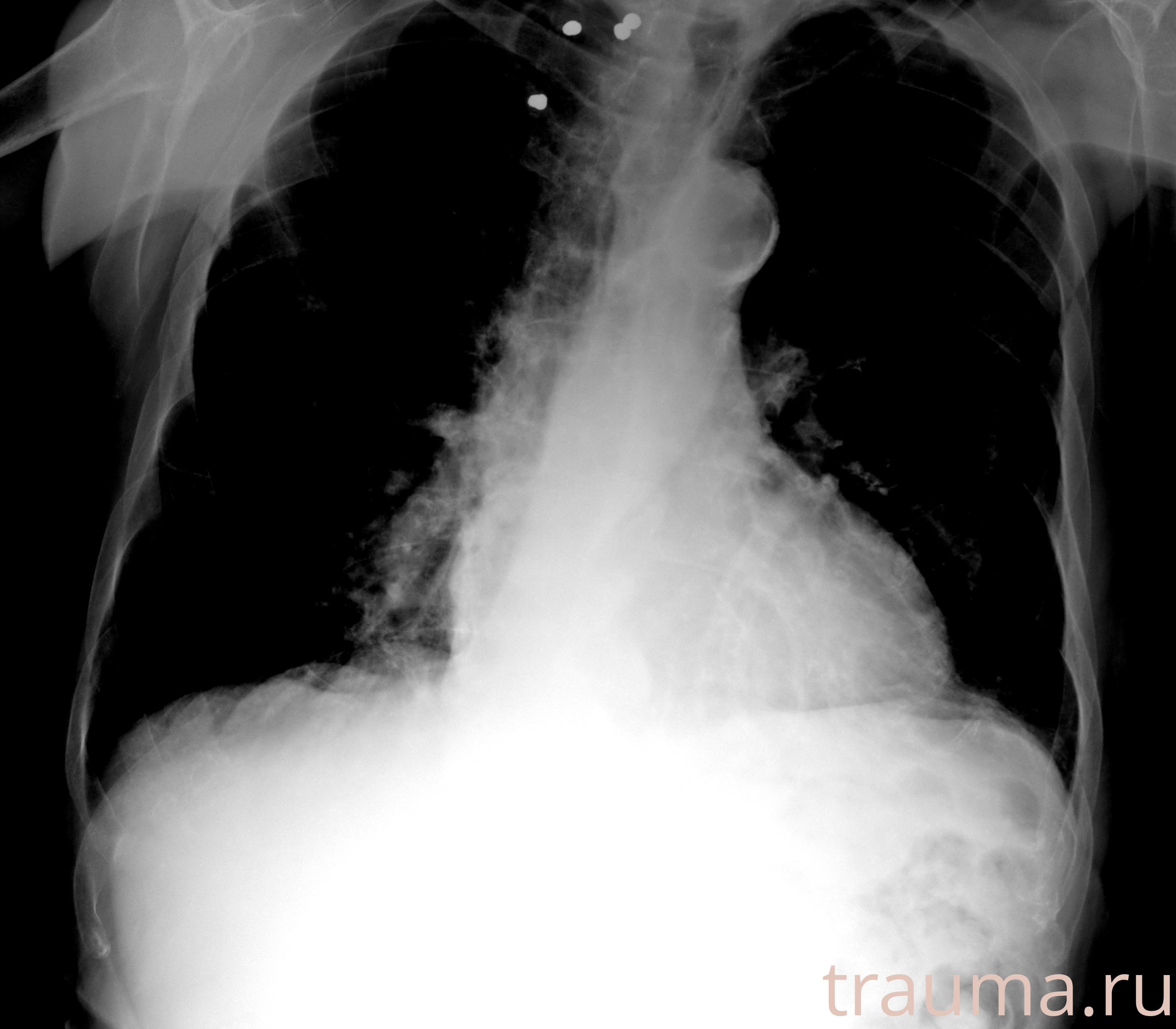 Рентген на дому: по вашему адресу приезжает врач-рентгенолог, травматолог-ортопед с мобильным рентгеновским аппаратом, проводит диагностику травмы или заболевания, делает необходимые рентгенограммы, дает рекомендации по дальнейшему лечению. Получить качественные снимки в домашних условиях возможно благодаря уникальной методике, разработанной МосРентген Центром для института  Склифосовского