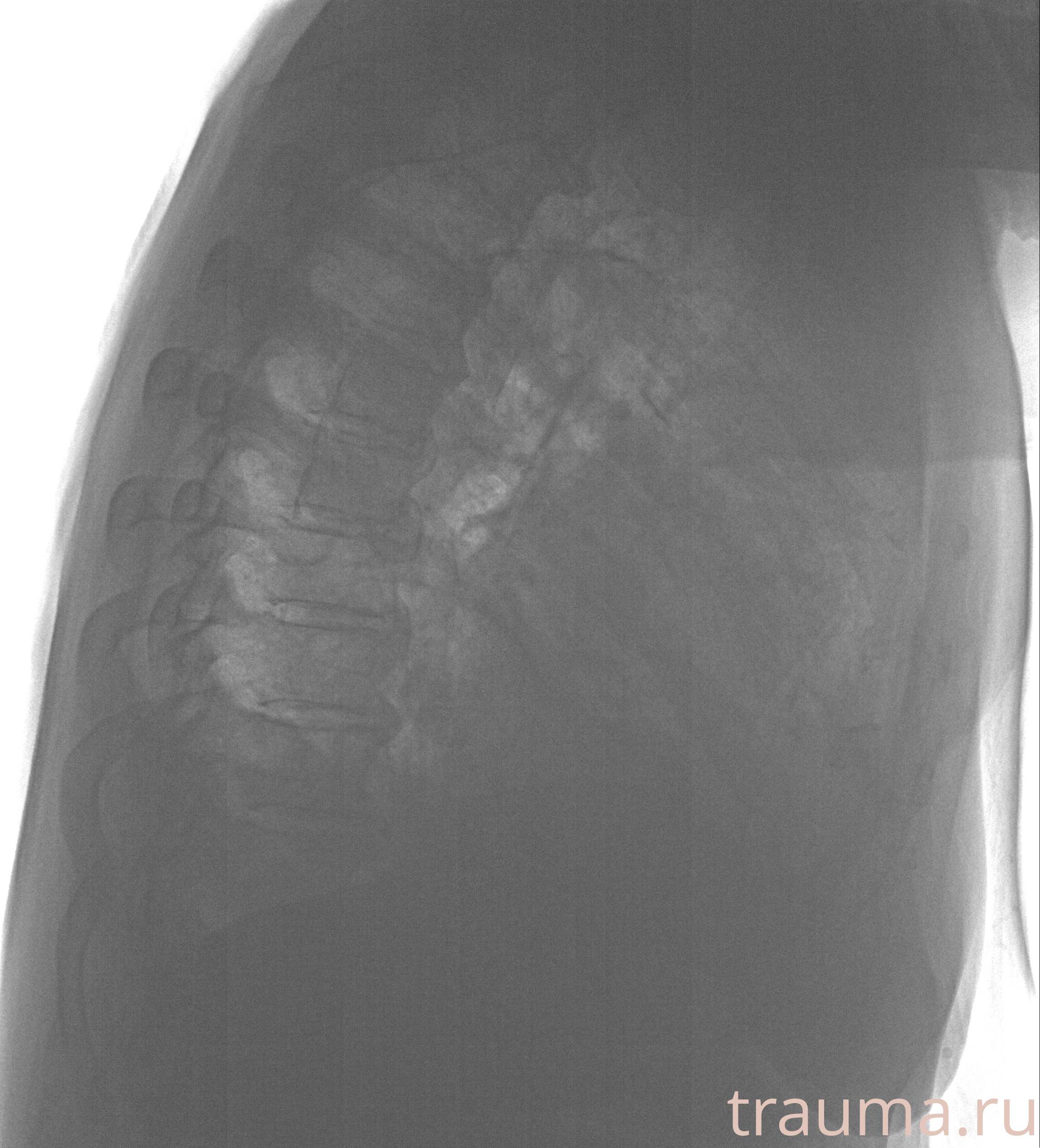 Рентген на дому: по вашему адресу приезжает врач-рентгенолог, травматолог-ортопед с мобильным рентгеновским аппаратом, проводит диагностику травмы или заболевания, делает необходимые рентгенограммы, дает рекомендации по дальнейшему лечению. Получить качественные снимки в домашних условиях возможно благодаря уникальной методике, разработанной МосРентген Центром для института  Склифосовского