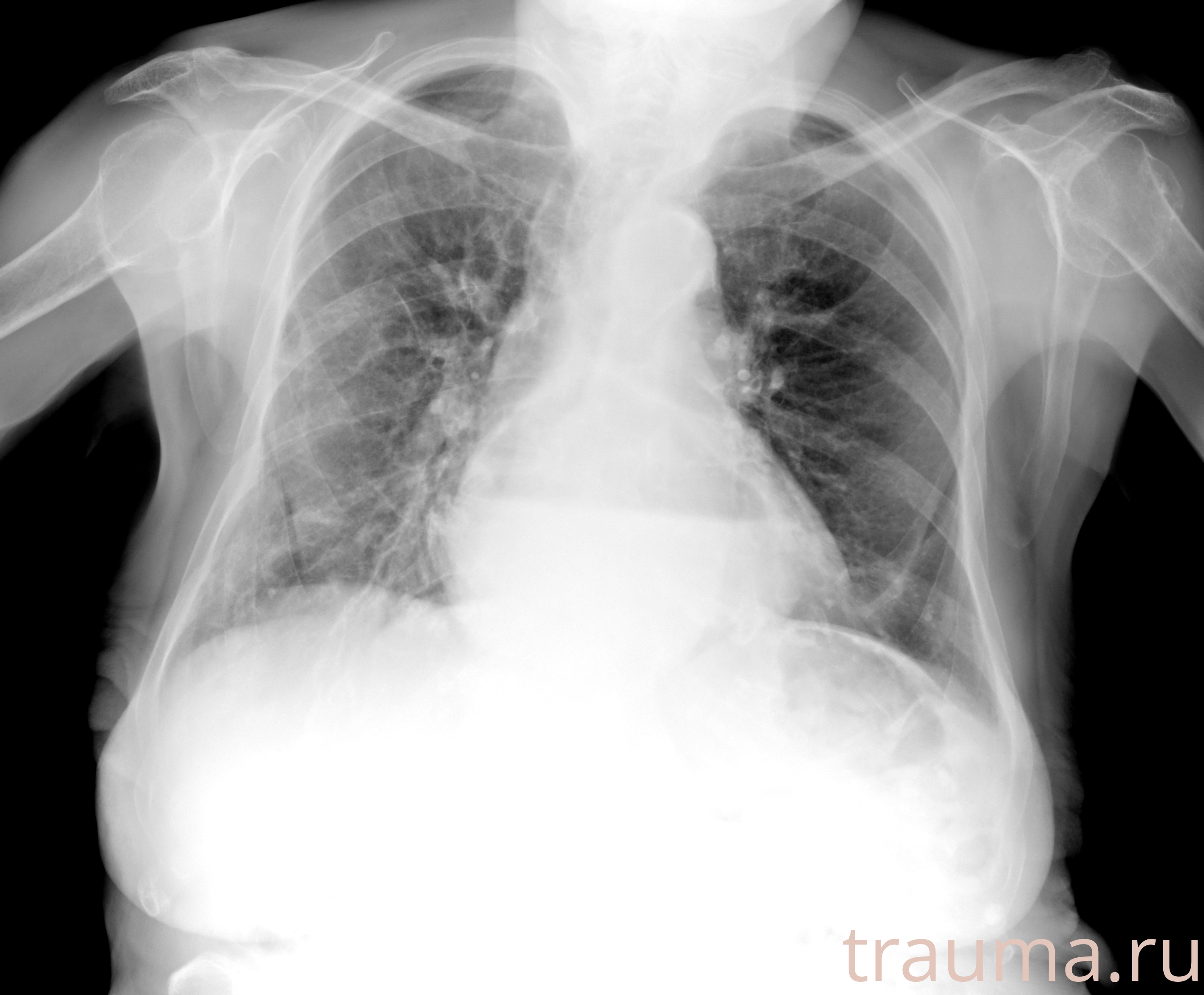 Рентген на дому: по вашему адресу приезжает врач-рентгенолог, травматолог-ортопед с мобильным рентгеновским аппаратом, проводит диагностику травмы или заболевания, делает необходимые рентгенограммы, дает рекомендации по дальнейшему лечению. Получить качественные снимки в домашних условиях возможно благодаря уникальной методике, разработанной МосРентген Центром для института  Склифосовского