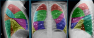 Рентгеноанатомические основы исследования легких. Учение о сегментах. Глава 14