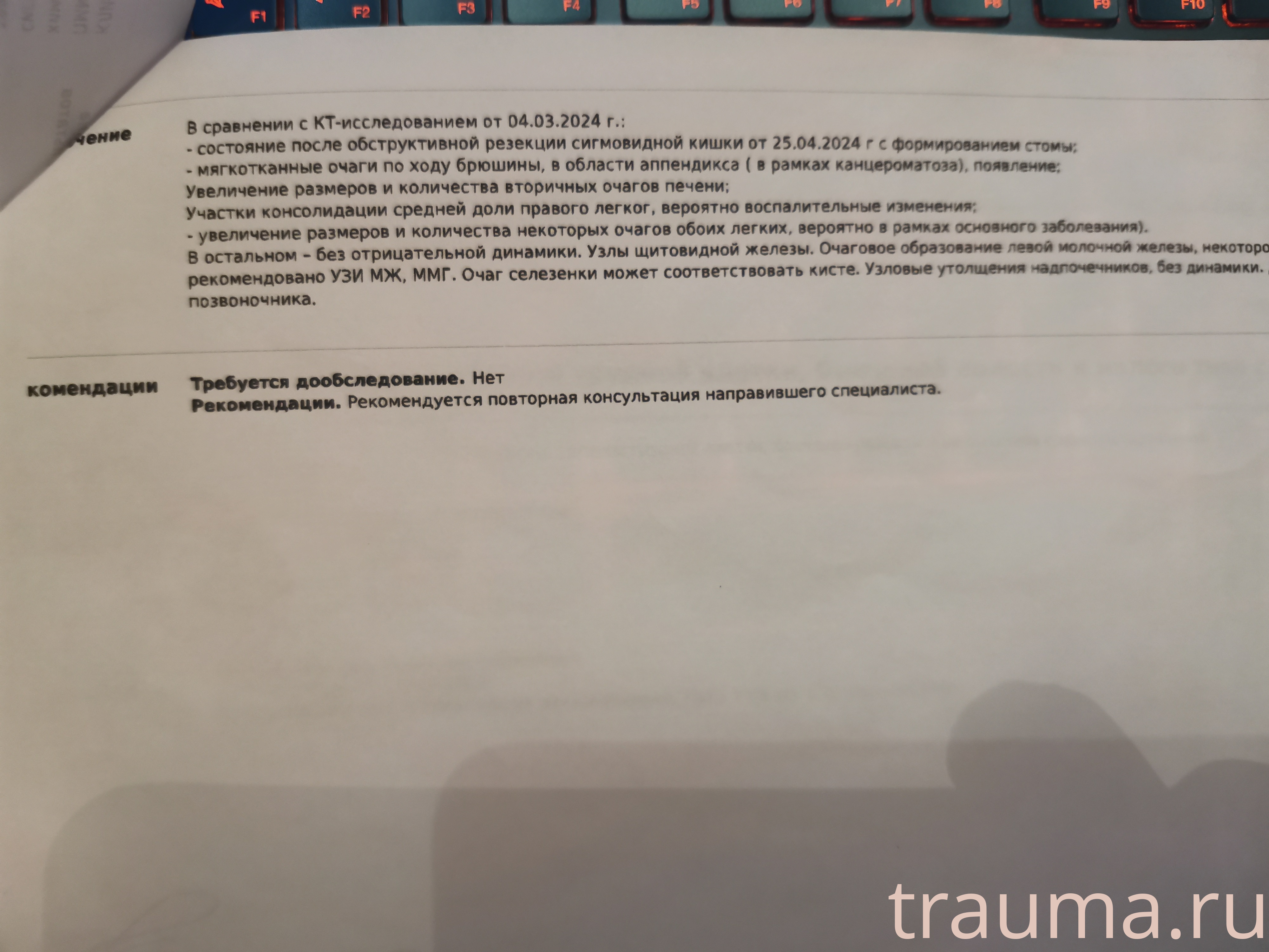 Рентген на дому: по вашему адресу приезжает врач-рентгенолог, травматолог-ортопед с мобильным рентгеновским аппаратом, проводит диагностику травмы или заболевания, делает необходимые рентгенограммы, дает рекомендации по дальнейшему лечению. Получить качественные снимки в домашних условиях возможно благодаря уникальной методике, разработанной МосРентген Центром для института  Склифосовского