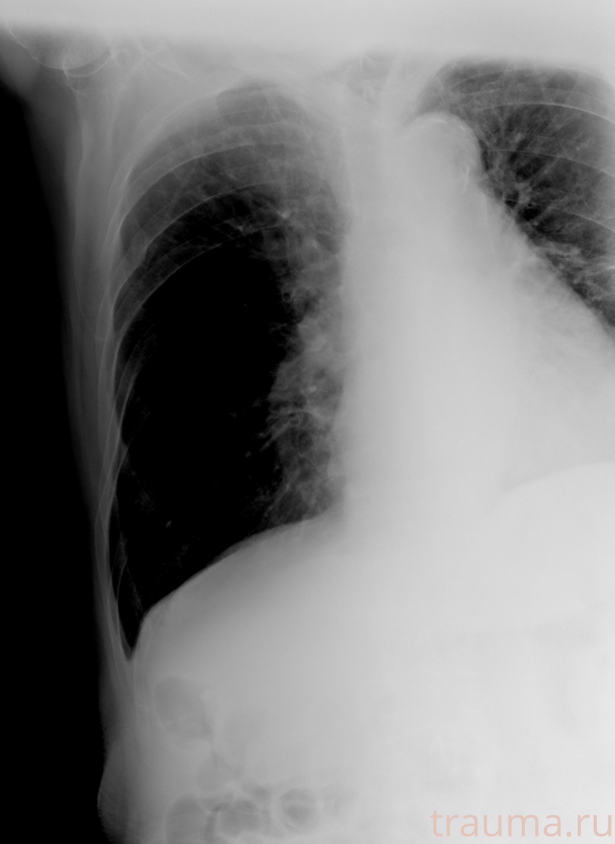 Рентген на дому: по вашему адресу приезжает врач-рентгенолог, травматолог-ортопед с мобильным рентгеновским аппаратом, проводит диагностику травмы или заболевания, делает необходимые рентгенограммы, дает рекомендации по дальнейшему лечению. Получить качественные снимки в домашних условиях возможно благодаря уникальной методике, разработанной МосРентген Центром для института  Склифосовского