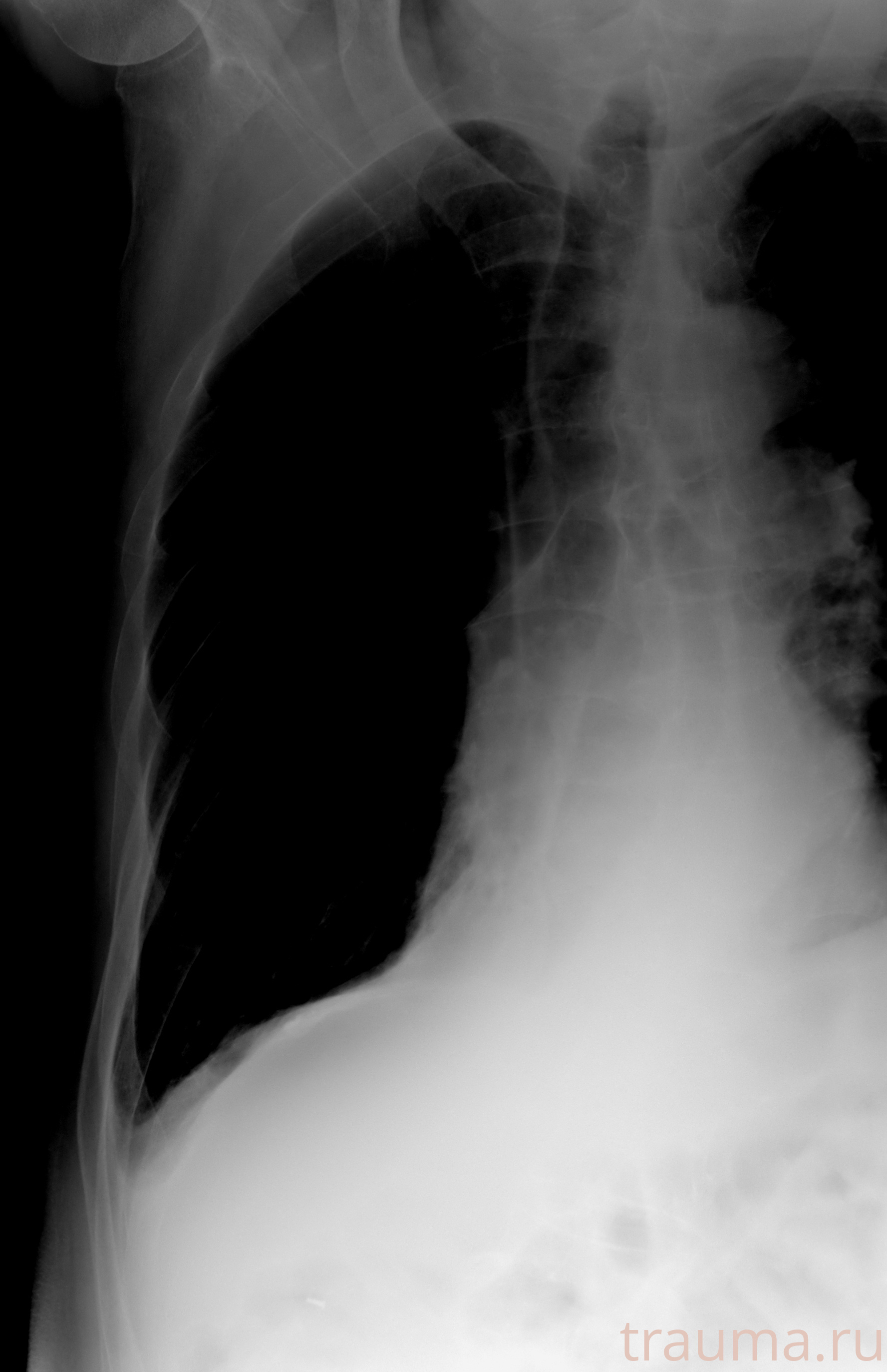 Рентген на дому: по вашему адресу приезжает врач-рентгенолог, травматолог-ортопед с мобильным рентгеновским аппаратом, проводит диагностику травмы или заболевания, делает необходимые рентгенограммы, дает рекомендации по дальнейшему лечению. Получить качественные снимки в домашних условиях возможно благодаря уникальной методике, разработанной МосРентген Центром для института  Склифосовского