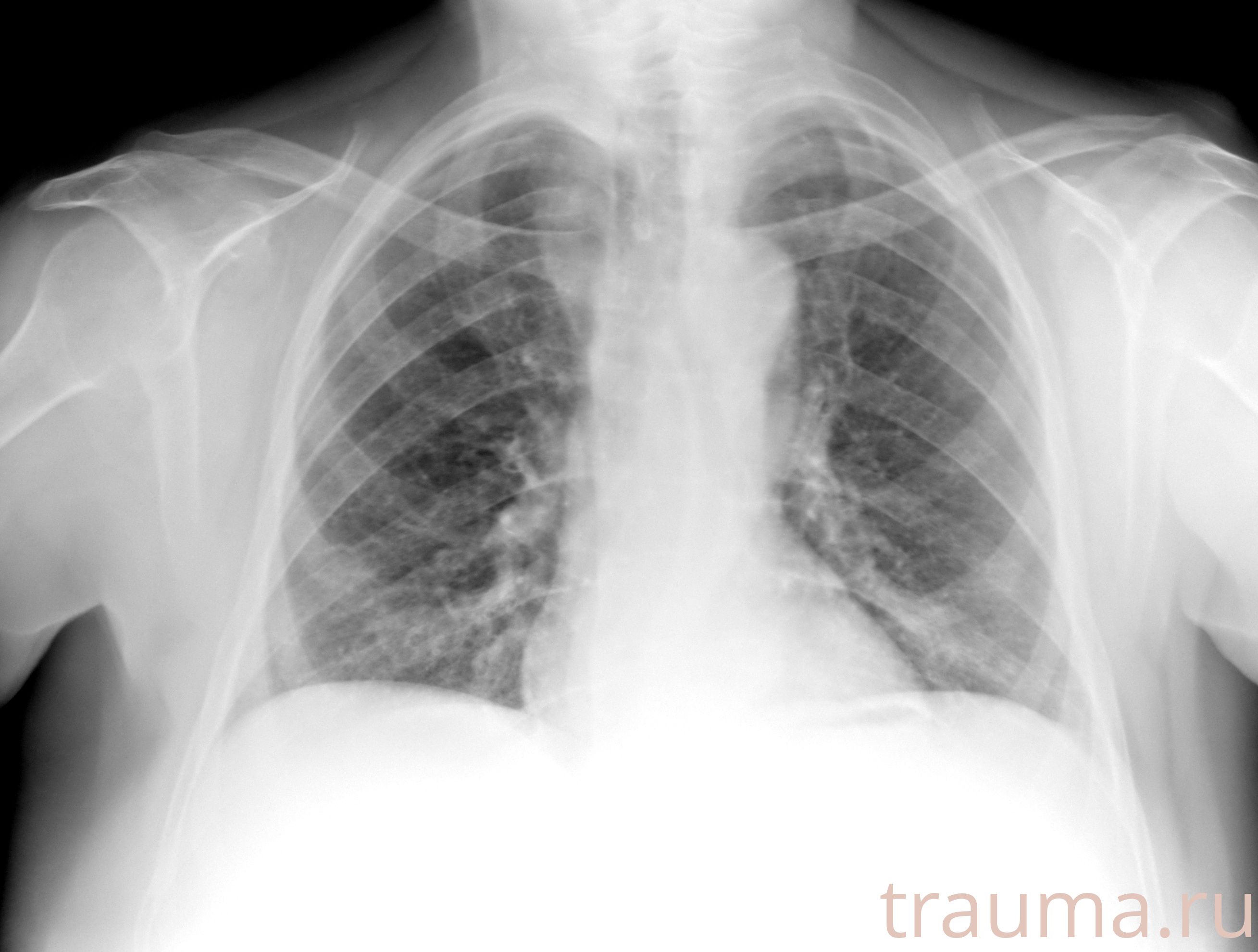 Рентген на дому: по вашему адресу приезжает врач-рентгенолог, травматолог-ортопед с мобильным рентгеновским аппаратом, проводит диагностику травмы или заболевания, делает необходимые рентгенограммы, дает рекомендации по дальнейшему лечению. Получить качественные снимки в домашних условиях возможно благодаря уникальной методике, разработанной МосРентген Центром для института  Склифосовского