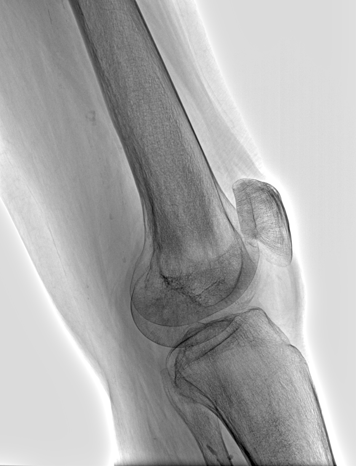 Рентген на дому: по вашему адресу приезжает врач-рентгенолог, травматолог-ортопед с мобильным рентгеновским аппаратом, проводит диагностику травмы или заболевания, делает необходимые рентгенограммы, дает рекомендации по дальнейшему лечению. Получить качественные снимки в домашних условиях возможно благодаря уникальной методике, разработанной МосРентген Центром для института  Склифосовского