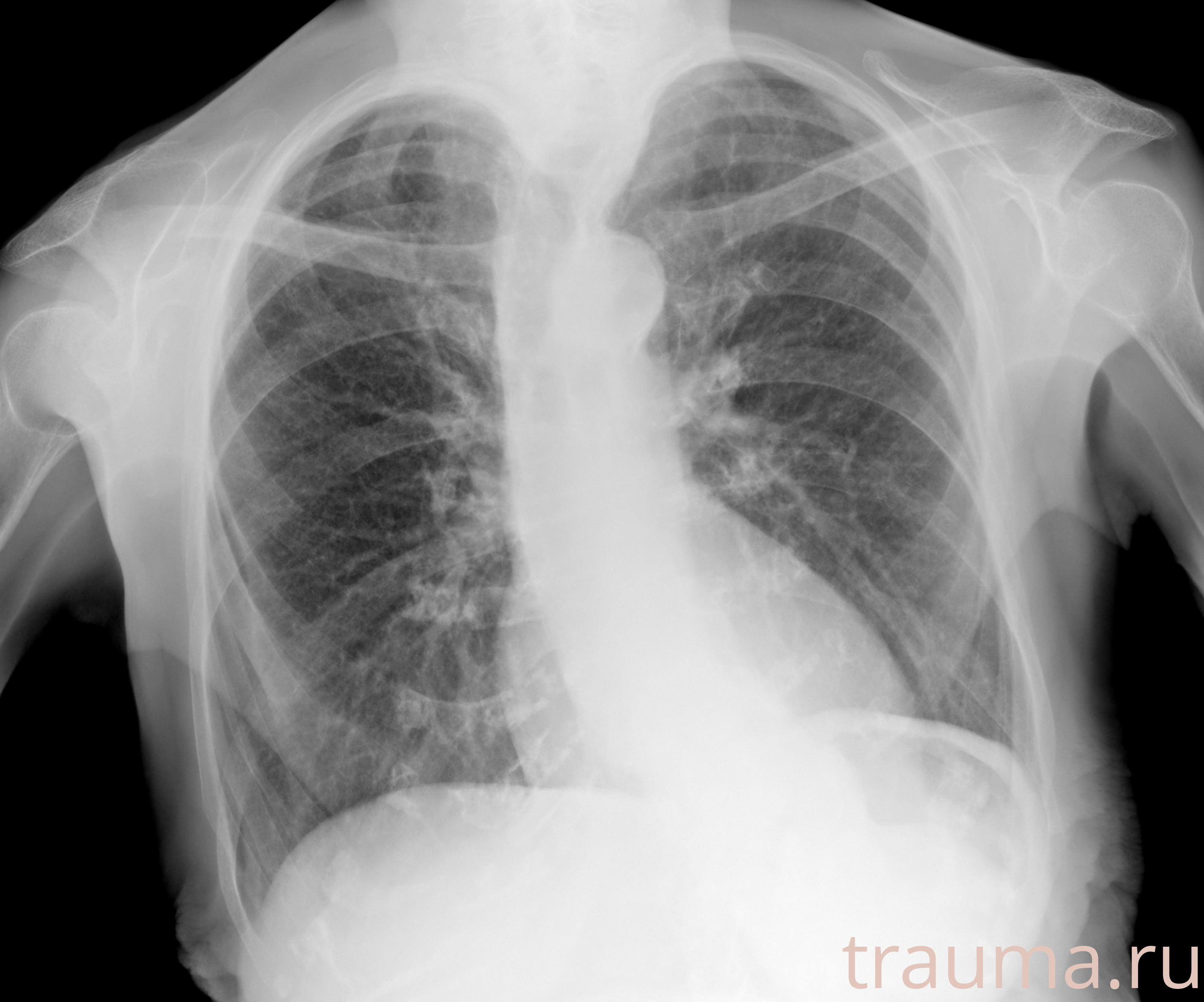 Рентген на дому: по вашему адресу приезжает врач-рентгенолог, травматолог-ортопед с мобильным рентгеновским аппаратом, проводит диагностику травмы или заболевания, делает необходимые рентгенограммы, дает рекомендации по дальнейшему лечению. Получить качественные снимки в домашних условиях возможно благодаря уникальной методике, разработанной МосРентген Центром для института  Склифосовского