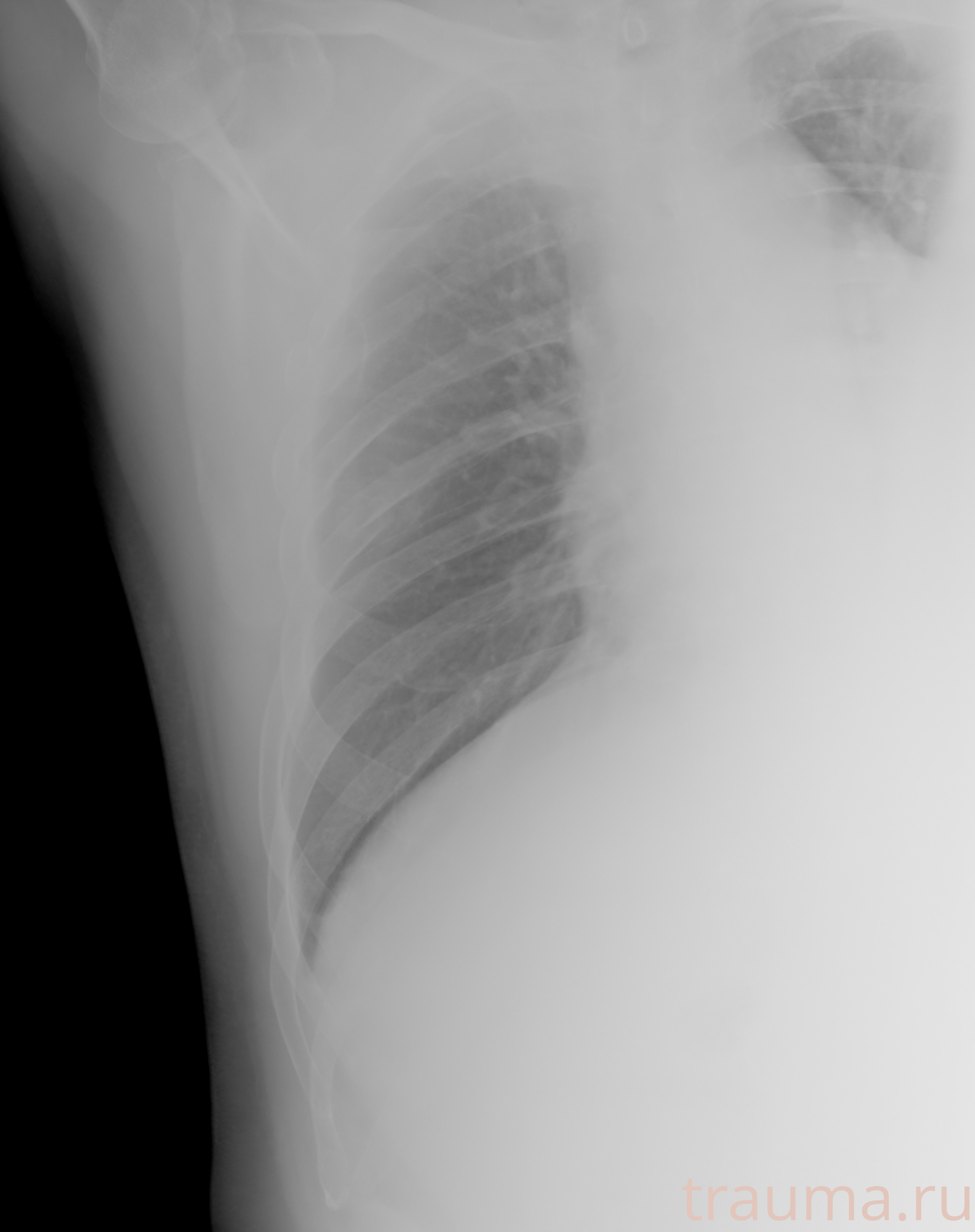 Рентген на дому: по вашему адресу приезжает врач-рентгенолог, травматолог-ортопед с мобильным рентгеновским аппаратом, проводит диагностику травмы или заболевания, делает необходимые рентгенограммы, дает рекомендации по дальнейшему лечению. Получить качественные снимки в домашних условиях возможно благодаря уникальной методике, разработанной МосРентген Центром для института  Склифосовского