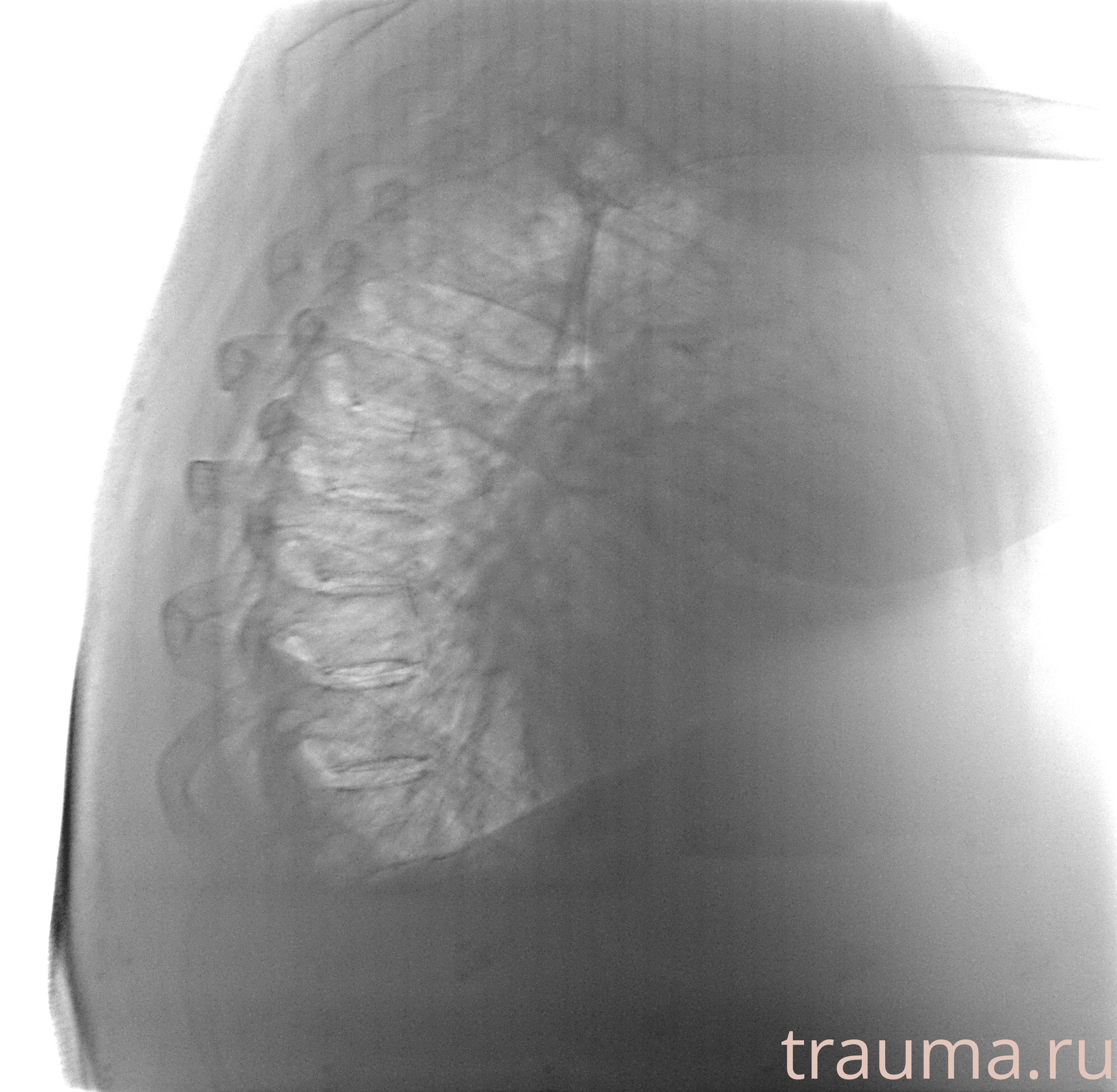 Рентген на дому: по вашему адресу приезжает врач-рентгенолог, травматолог-ортопед с мобильным рентгеновским аппаратом, проводит диагностику травмы или заболевания, делает необходимые рентгенограммы, дает рекомендации по дальнейшему лечению. Получить качественные снимки в домашних условиях возможно благодаря уникальной методике, разработанной МосРентген Центром для института  Склифосовского