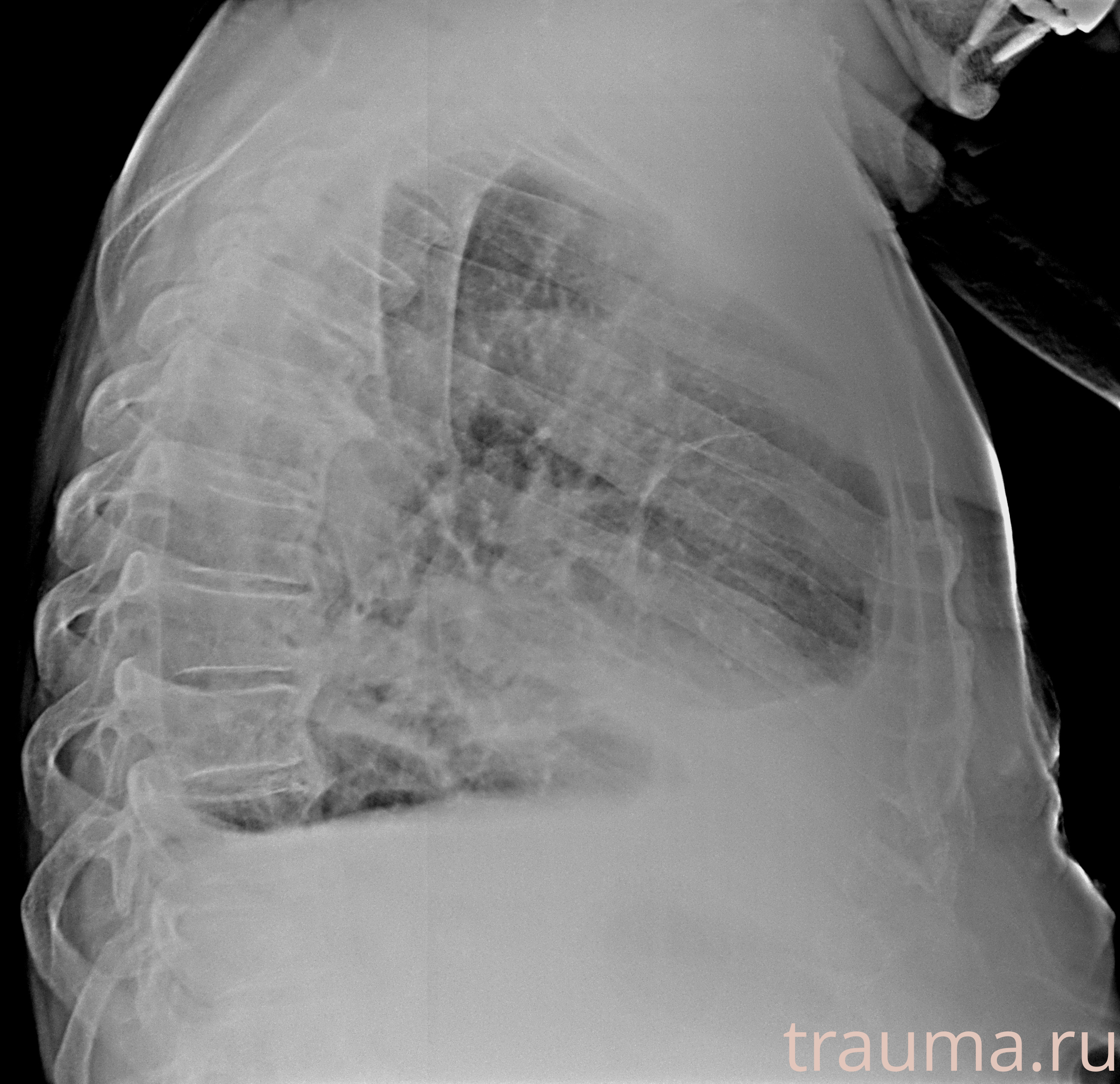 Рентген на дому: по вашему адресу приезжает врач-рентгенолог, травматолог-ортопед с мобильным рентгеновским аппаратом, проводит диагностику травмы или заболевания, делает необходимые рентгенограммы, дает рекомендации по дальнейшему лечению. Получить качественные снимки в домашних условиях возможно благодаря уникальной методике, разработанной МосРентген Центром для института  Склифосовского