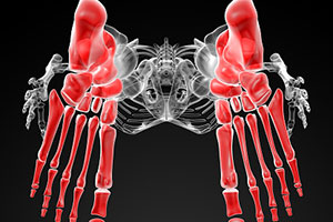 Показано разрушительное воздействие рентгена на кости