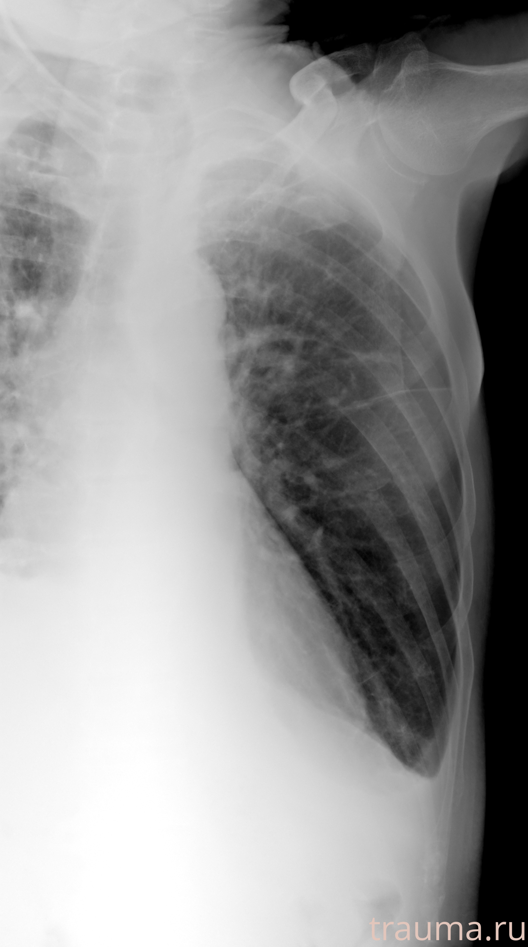 Рентген на дому: по вашему адресу приезжает врач-рентгенолог, травматолог-ортопед с мобильным рентгеновским аппаратом, проводит диагностику травмы или заболевания, делает необходимые рентгенограммы, дает рекомендации по дальнейшему лечению. Получить качественные снимки в домашних условиях возможно благодаря уникальной методике, разработанной МосРентген Центром для института  Склифосовского