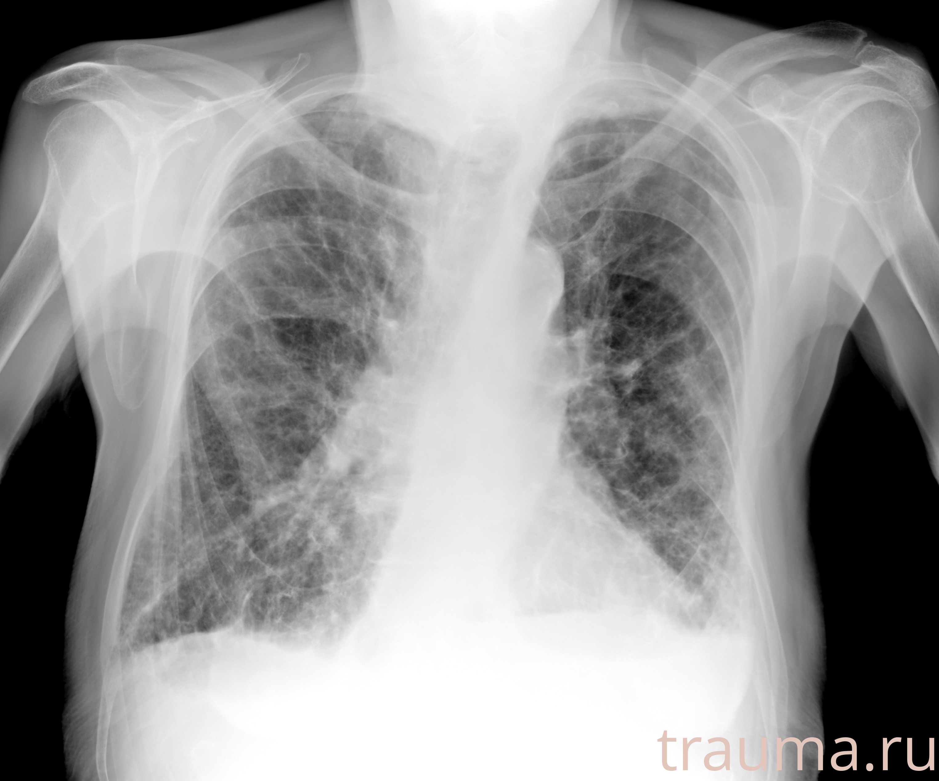 Рентген на дому: по вашему адресу приезжает врач-рентгенолог, травматолог-ортопед с мобильным рентгеновским аппаратом, проводит диагностику травмы или заболевания, делает необходимые рентгенограммы, дает рекомендации по дальнейшему лечению. Получить качественные снимки в домашних условиях возможно благодаря уникальной методике, разработанной МосРентген Центром для института  Склифосовского