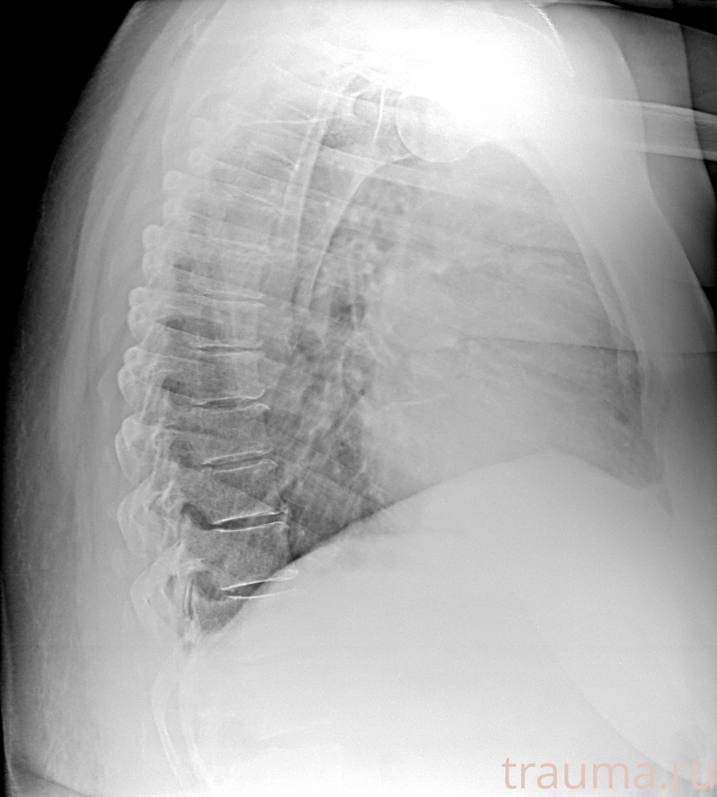 Рентген на дому: по вашему адресу приезжает врач-рентгенолог, травматолог-ортопед с мобильным рентгеновским аппаратом, проводит диагностику травмы или заболевания, делает необходимые рентгенограммы, дает рекомендации по дальнейшему лечению. Получить качественные снимки в домашних условиях возможно благодаря уникальной методике, разработанной МосРентген Центром для института  Склифосовского